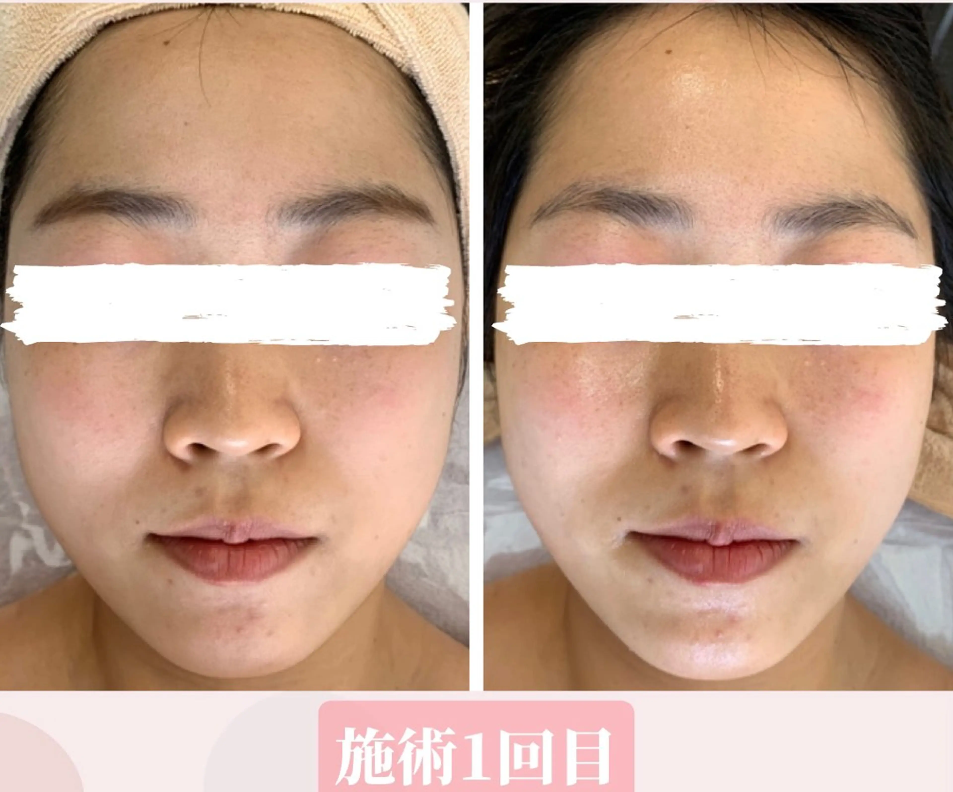 小顔&デコルテ Spa　“koti”のエステ・リラクイメージ