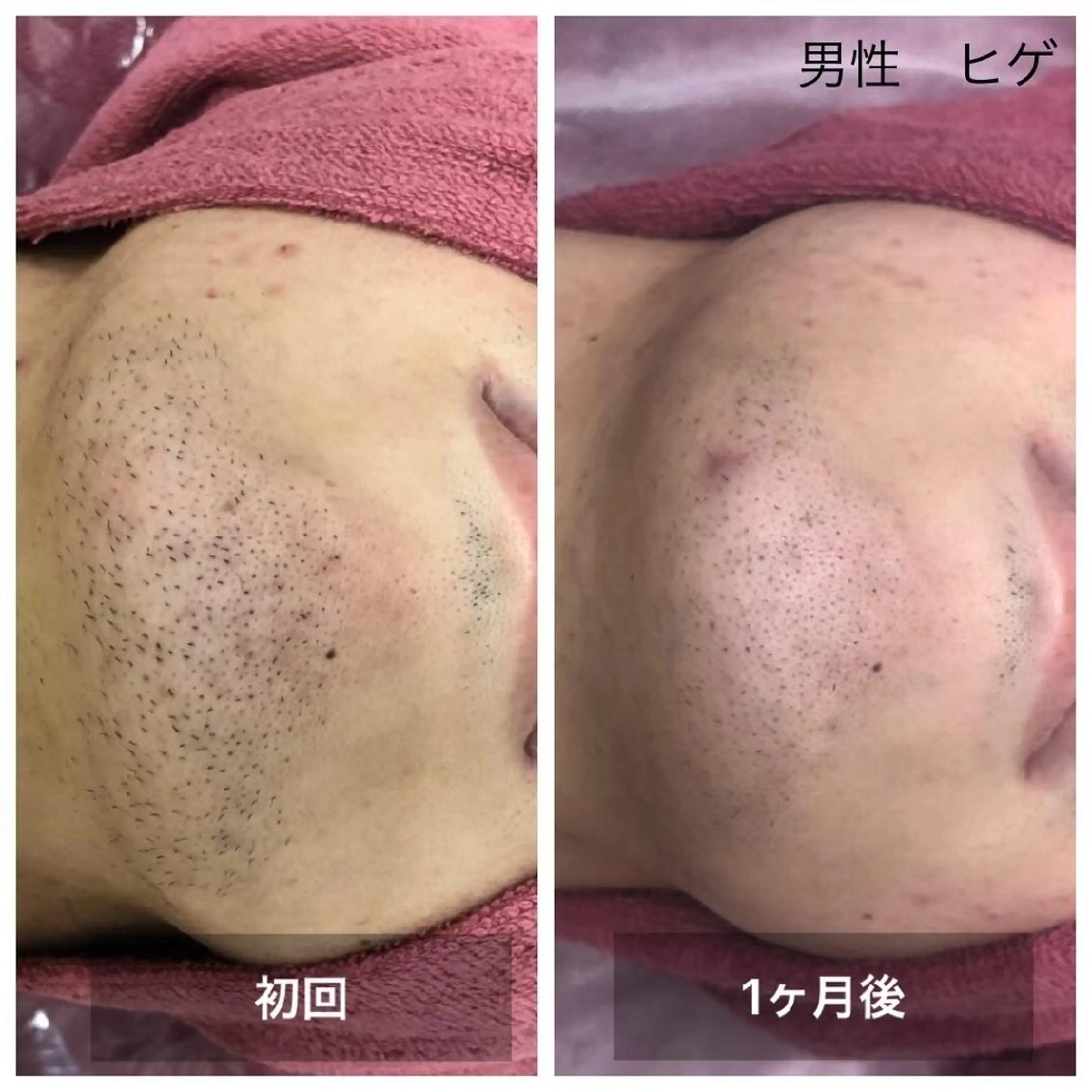 美容＆脱毛サロン 金沢文庫のエステ・リラクイメージ