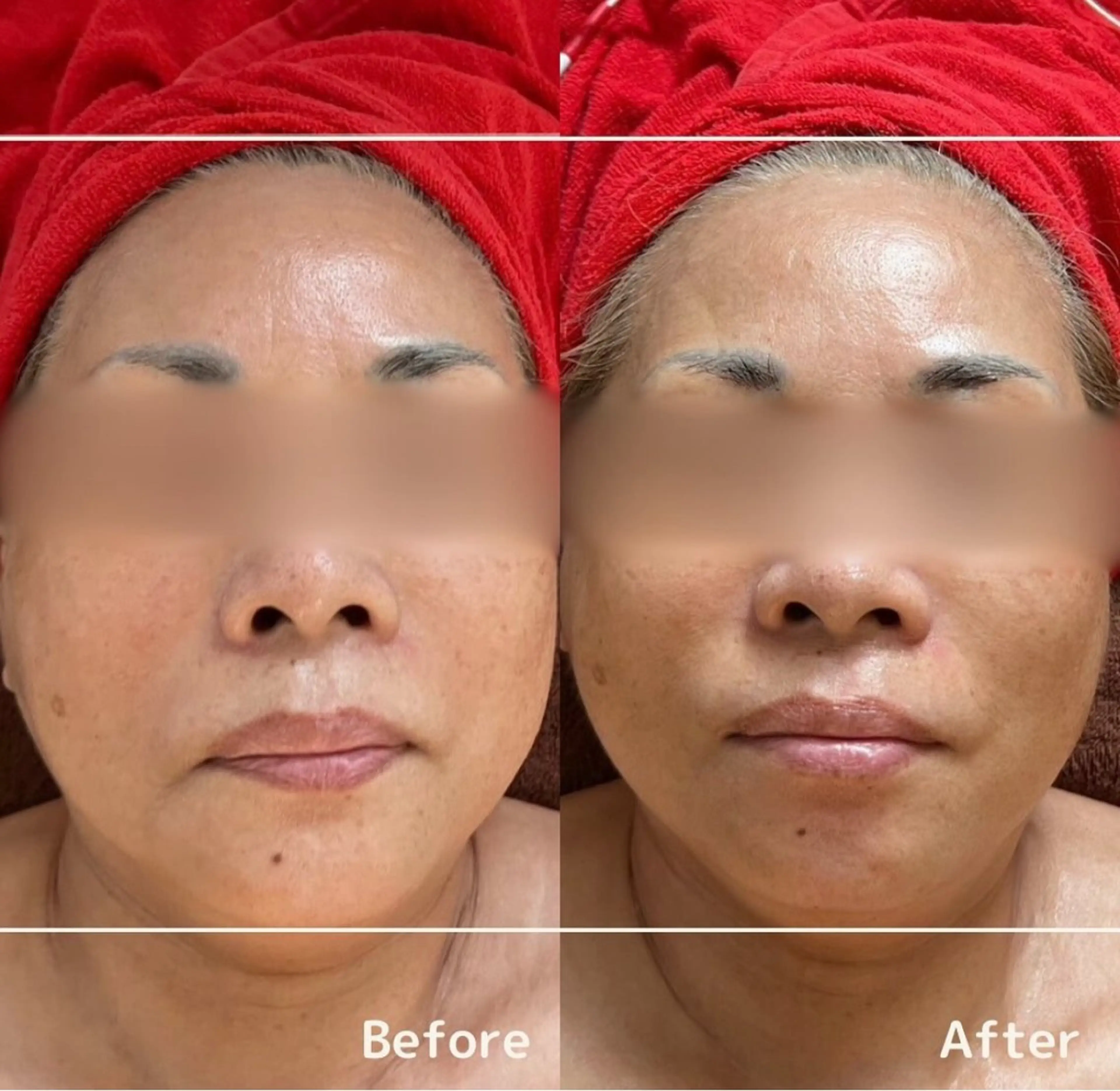 【本気で美しくなりたい方はコチラ✨】細胞活性トリートメントの写真