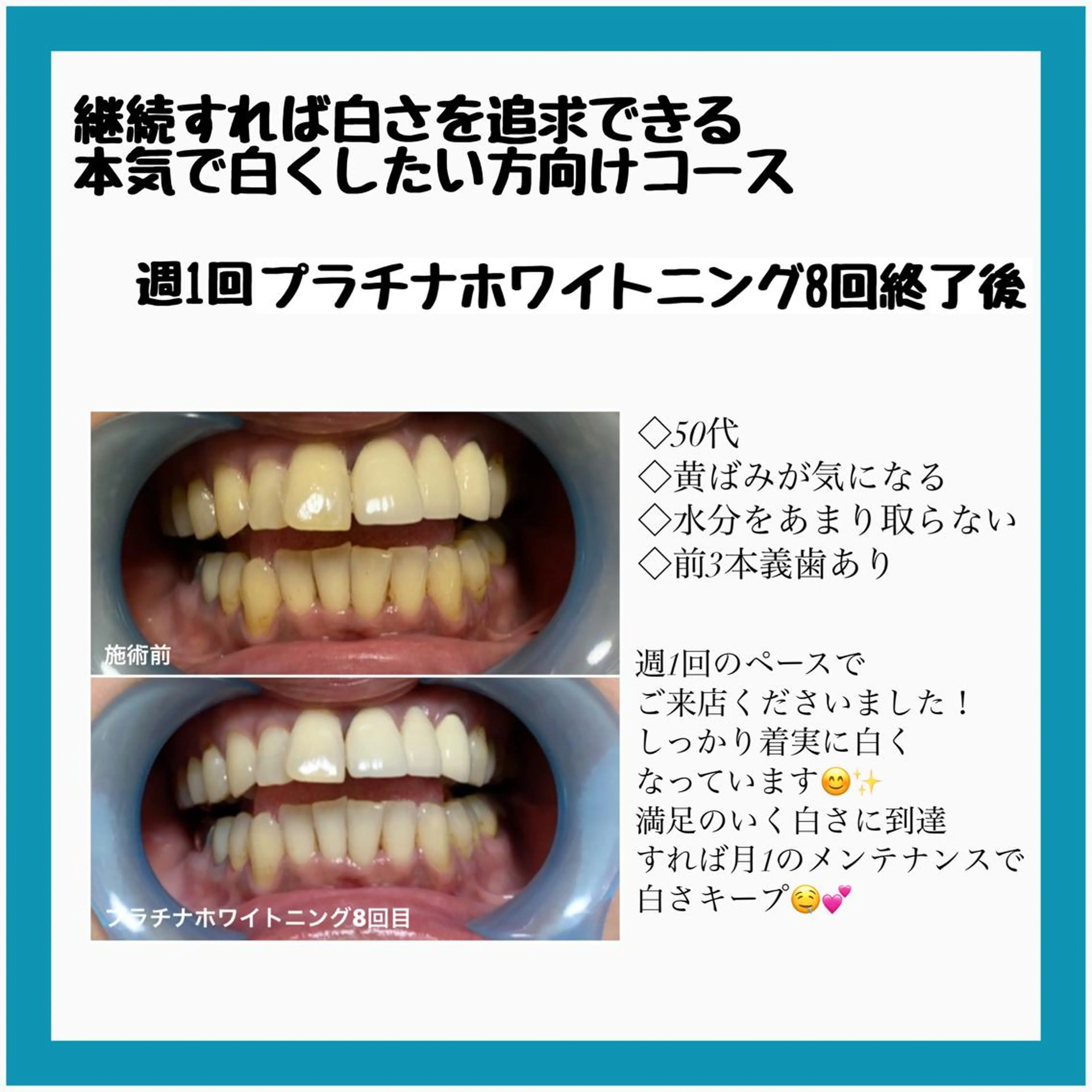 ネイル/耳つぼ /新ホワイトニングのネイルデザイン