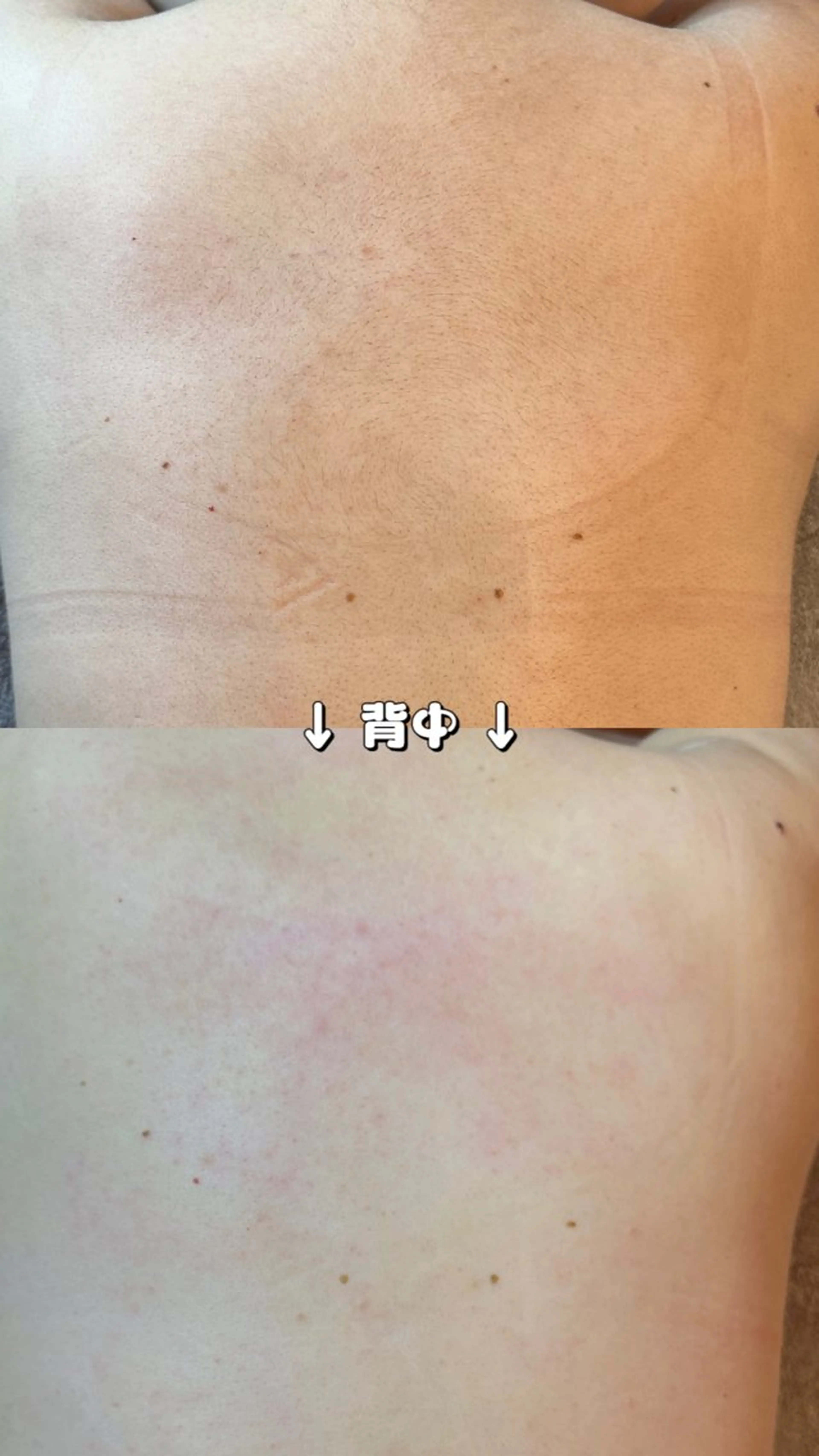 Hit. シュガーリング豊橋のエステ・リラクイメージ