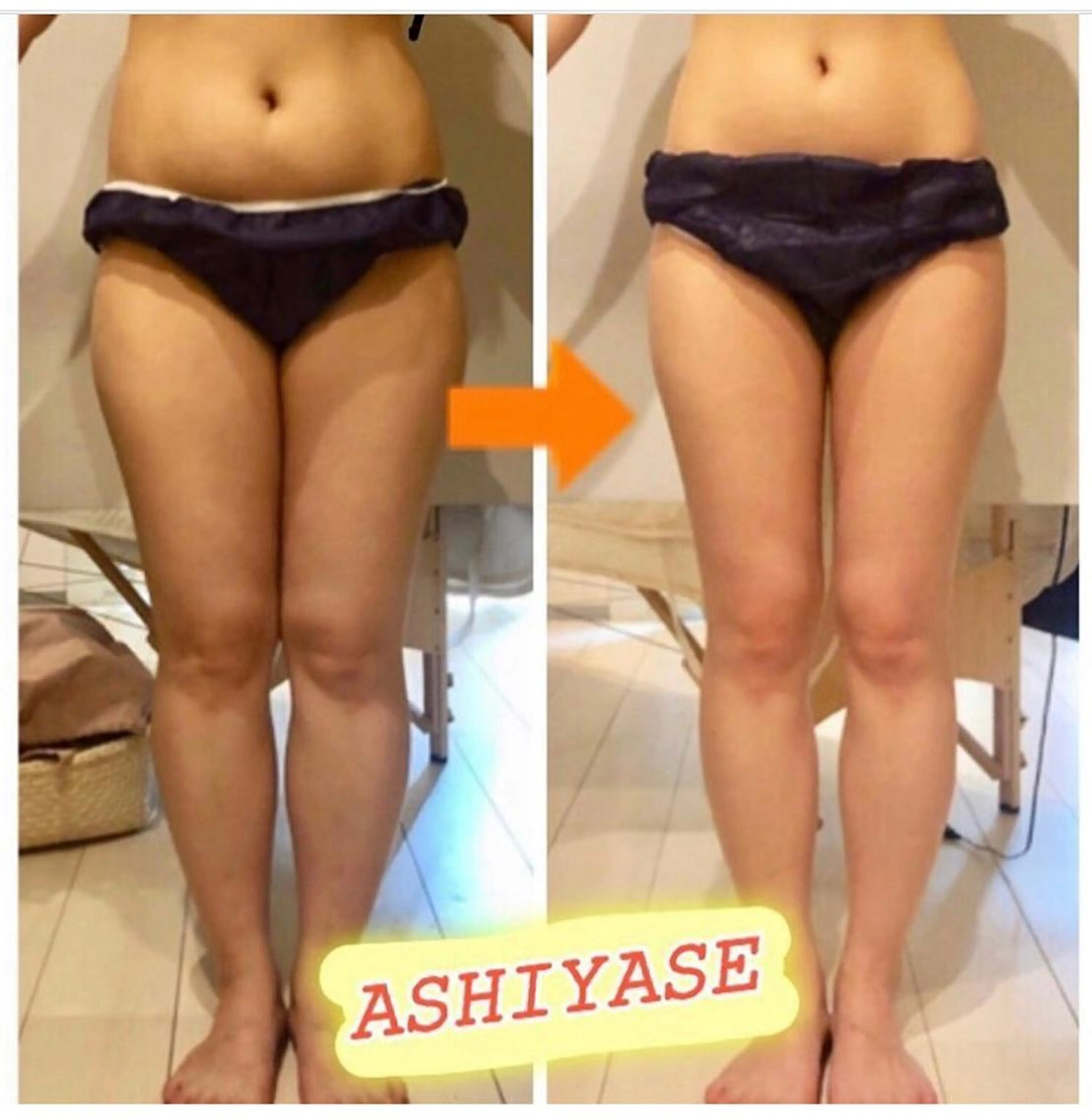 ショート カラー パーマ ヘアアレンジ メンズ キッズ ネイル マツエク・マツパ ‍痩身＆ボディ 結果出し🌟丹野のエステ・リラクイメージ