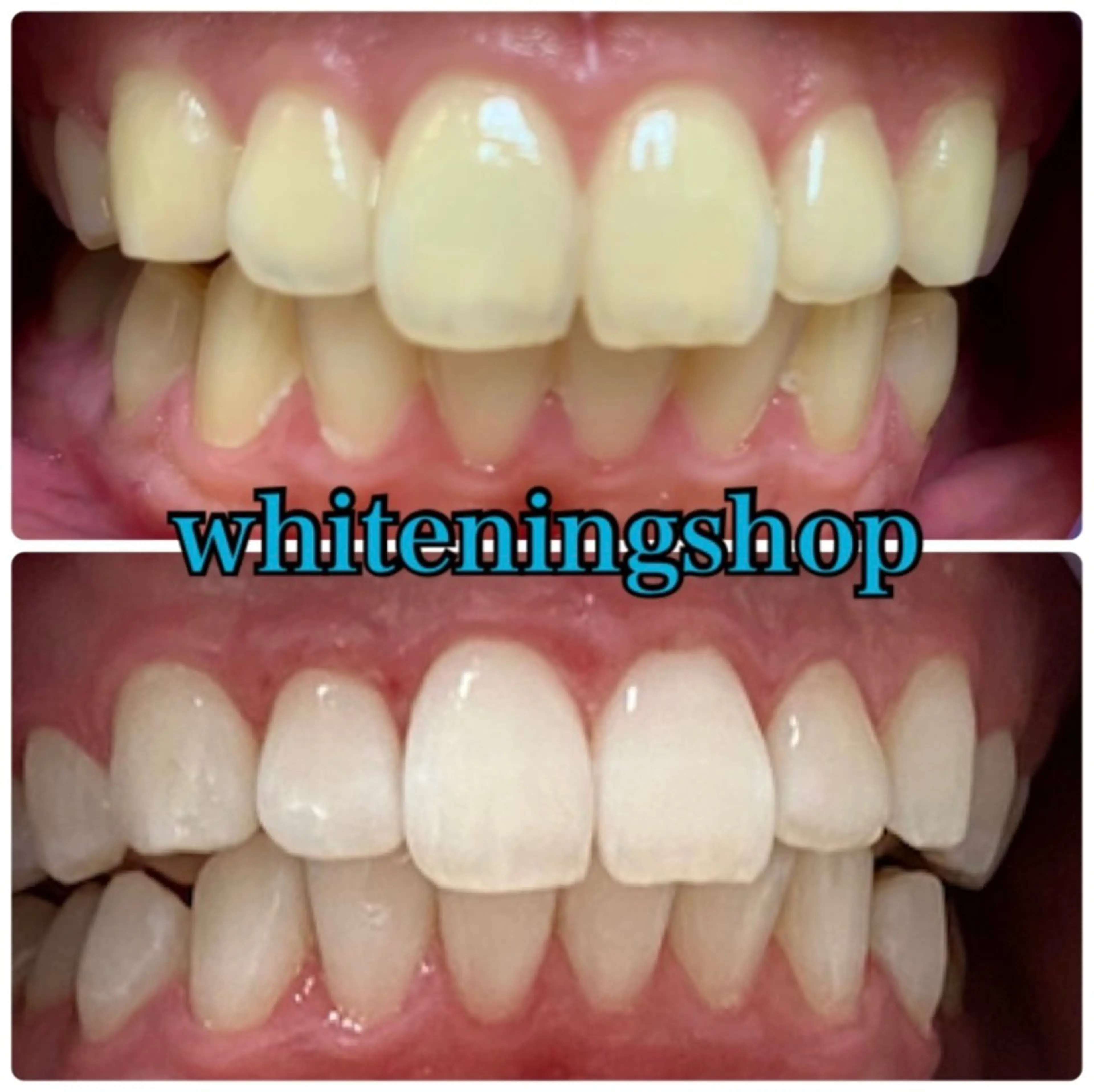 エステ リラク ホワイトニング ショップ吉祥寺店のエステ・リラクイメージ