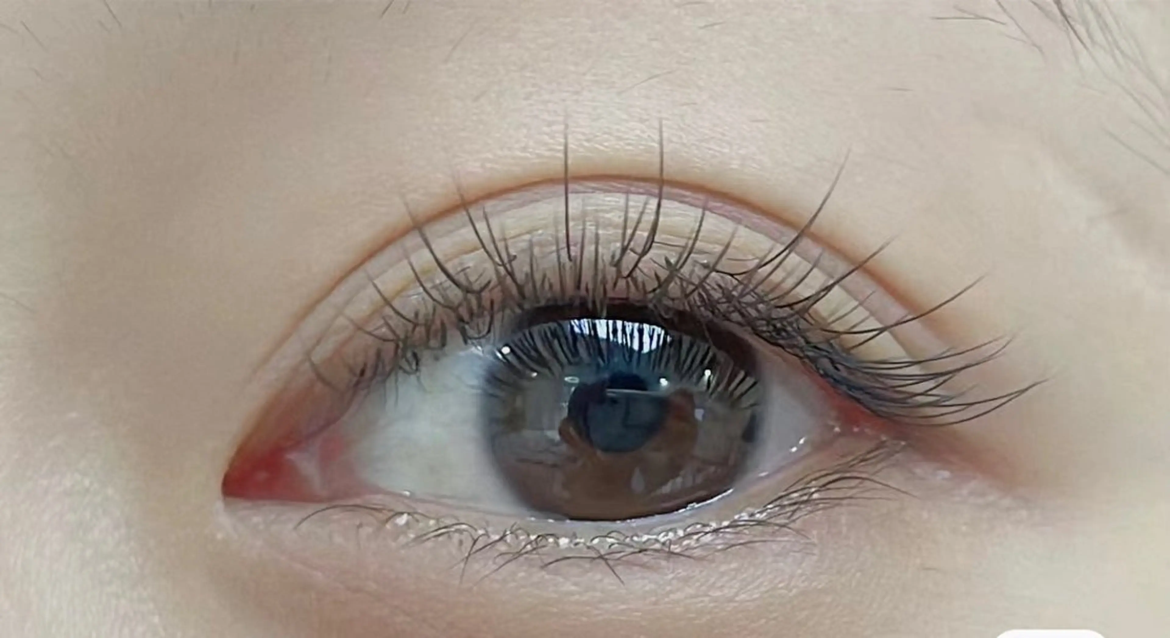 フッラトラッシュ100本の写真