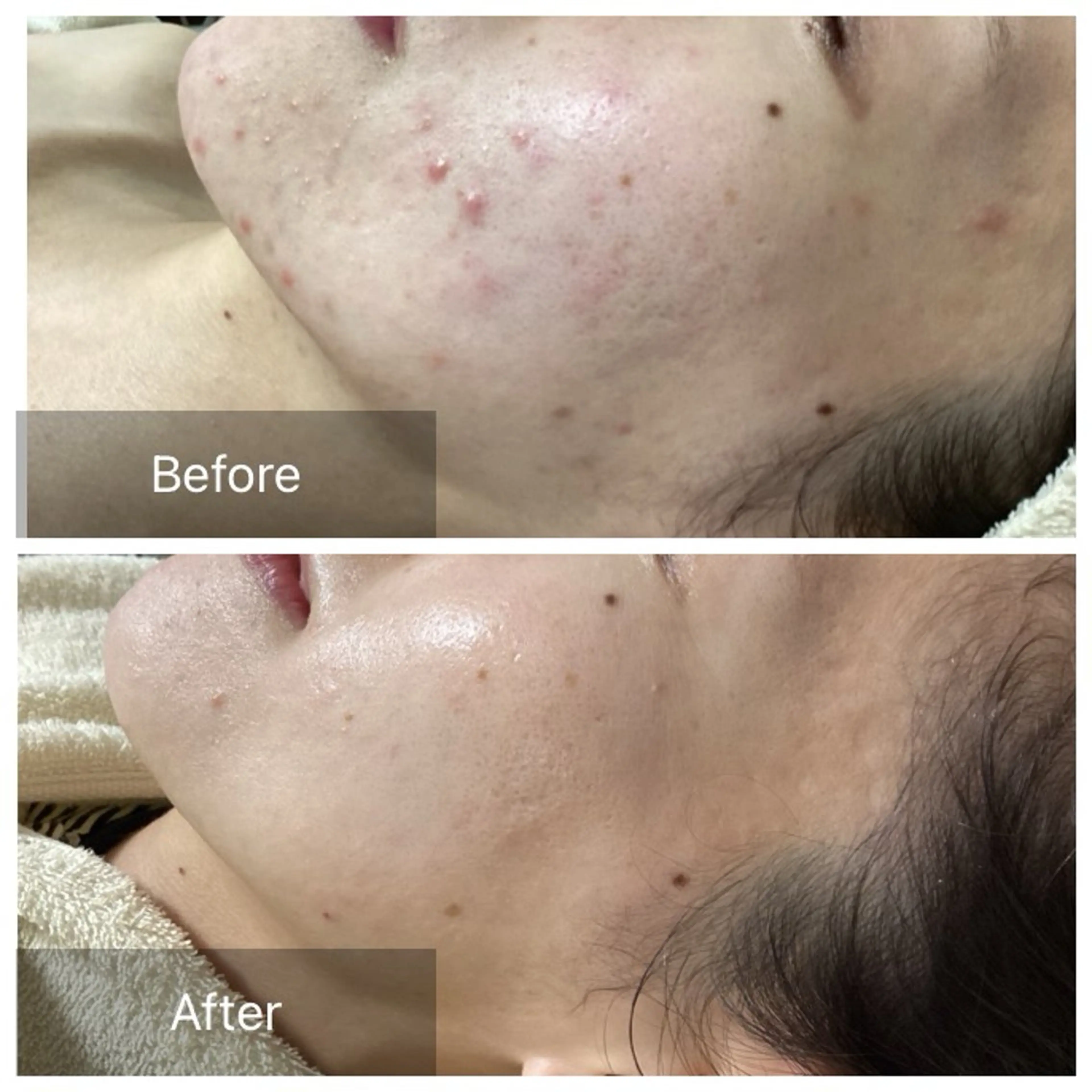 エステ Dahlia Moriのエステ・リラクイメージ