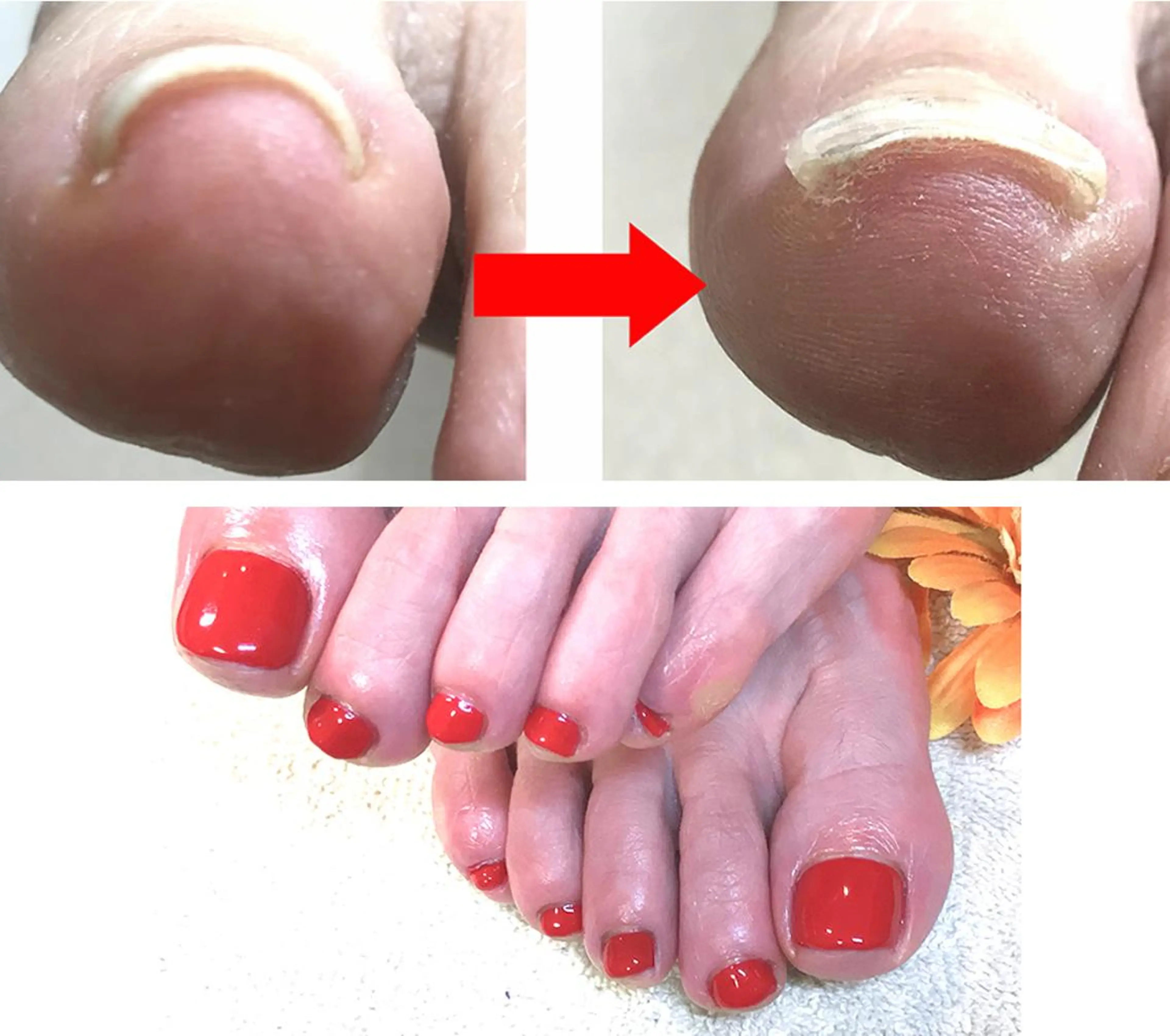 ネイル フットネイル ジェルネイル ワンカラーネイル イワサキ  のネイルデザイン