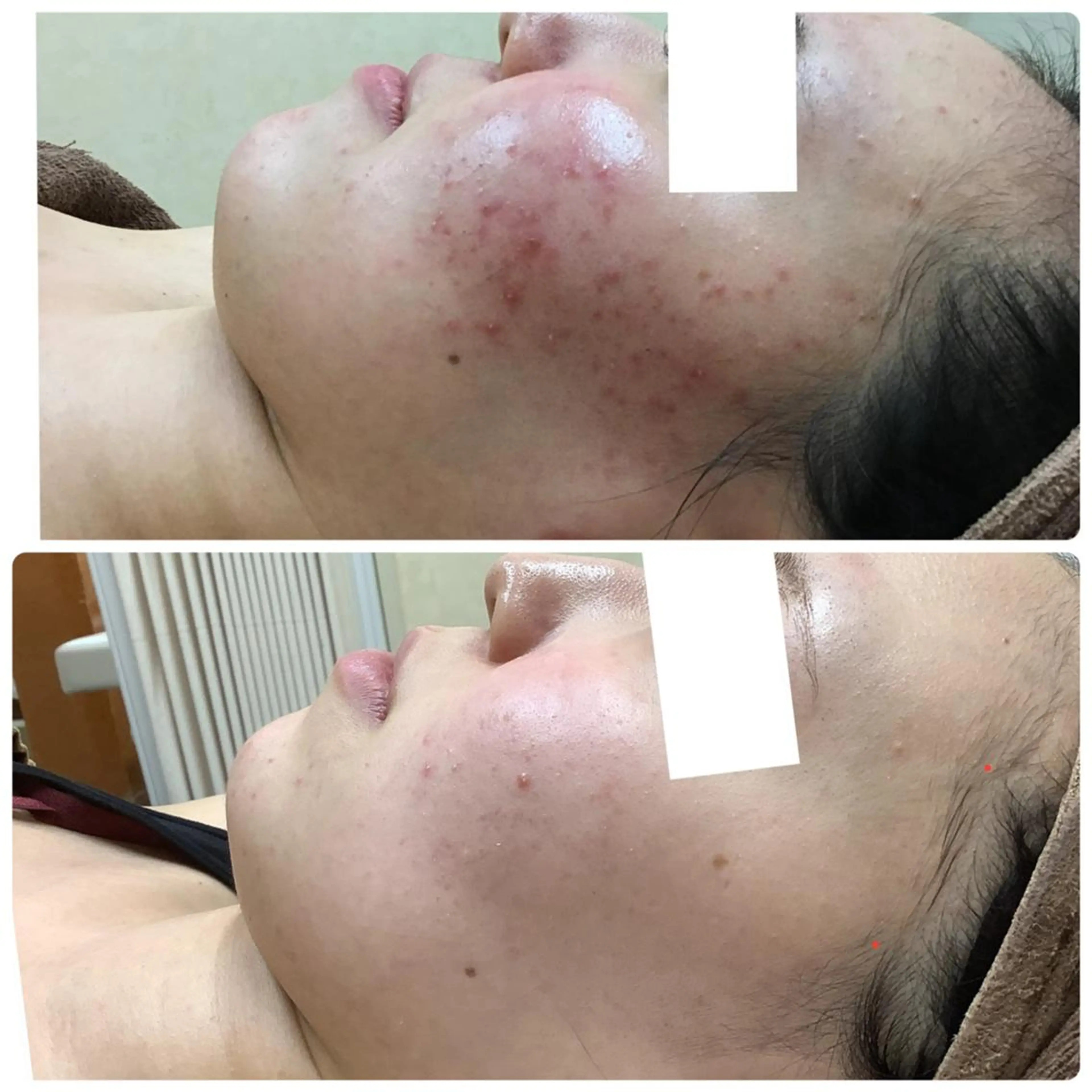 エステ エステティックレイ ビス秋田店　菅野のエステ・リラクイメージ