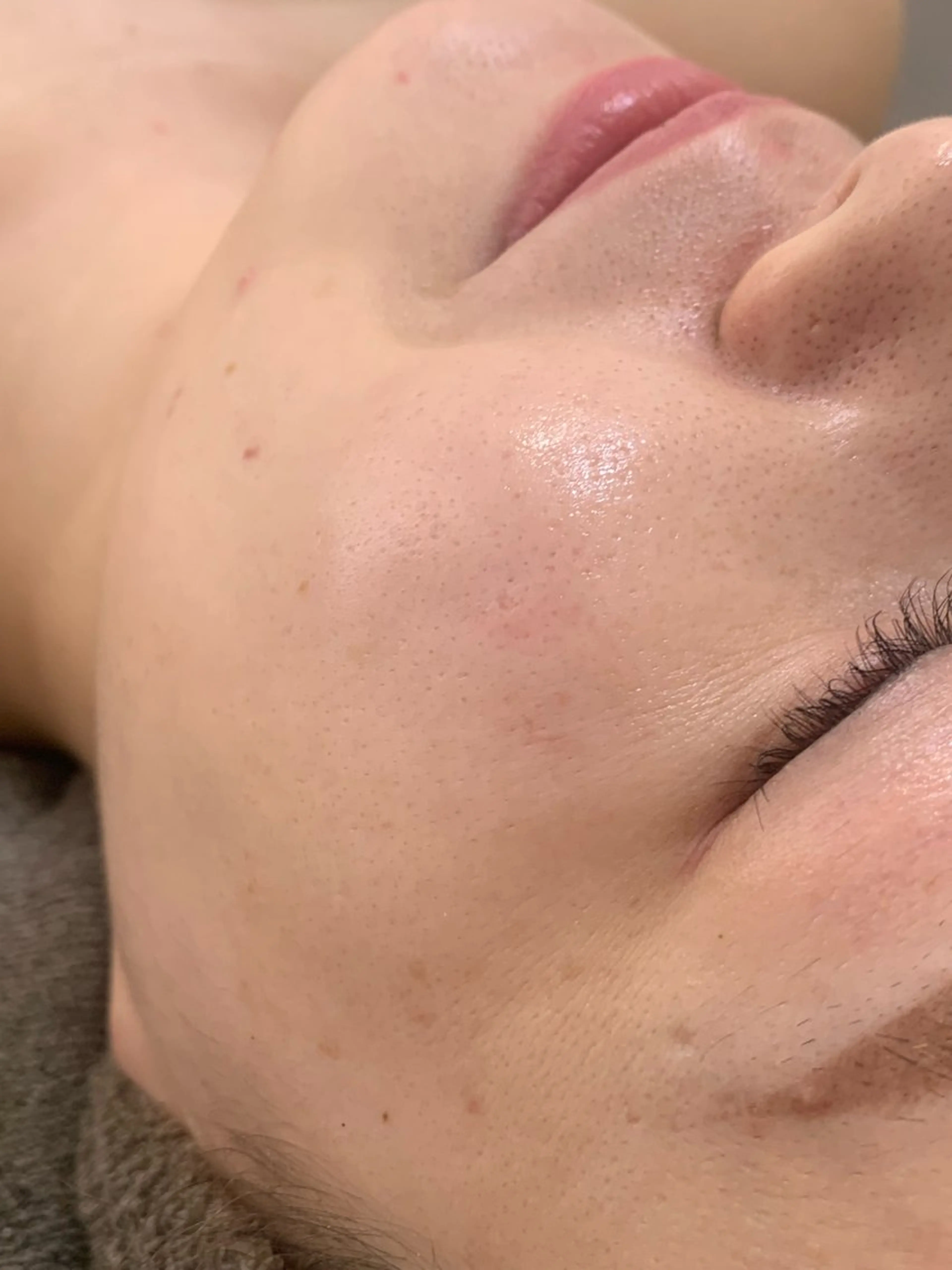 one day所属・肌質改善ハーブサロン ALA原宿のエステ・リラクイメージ