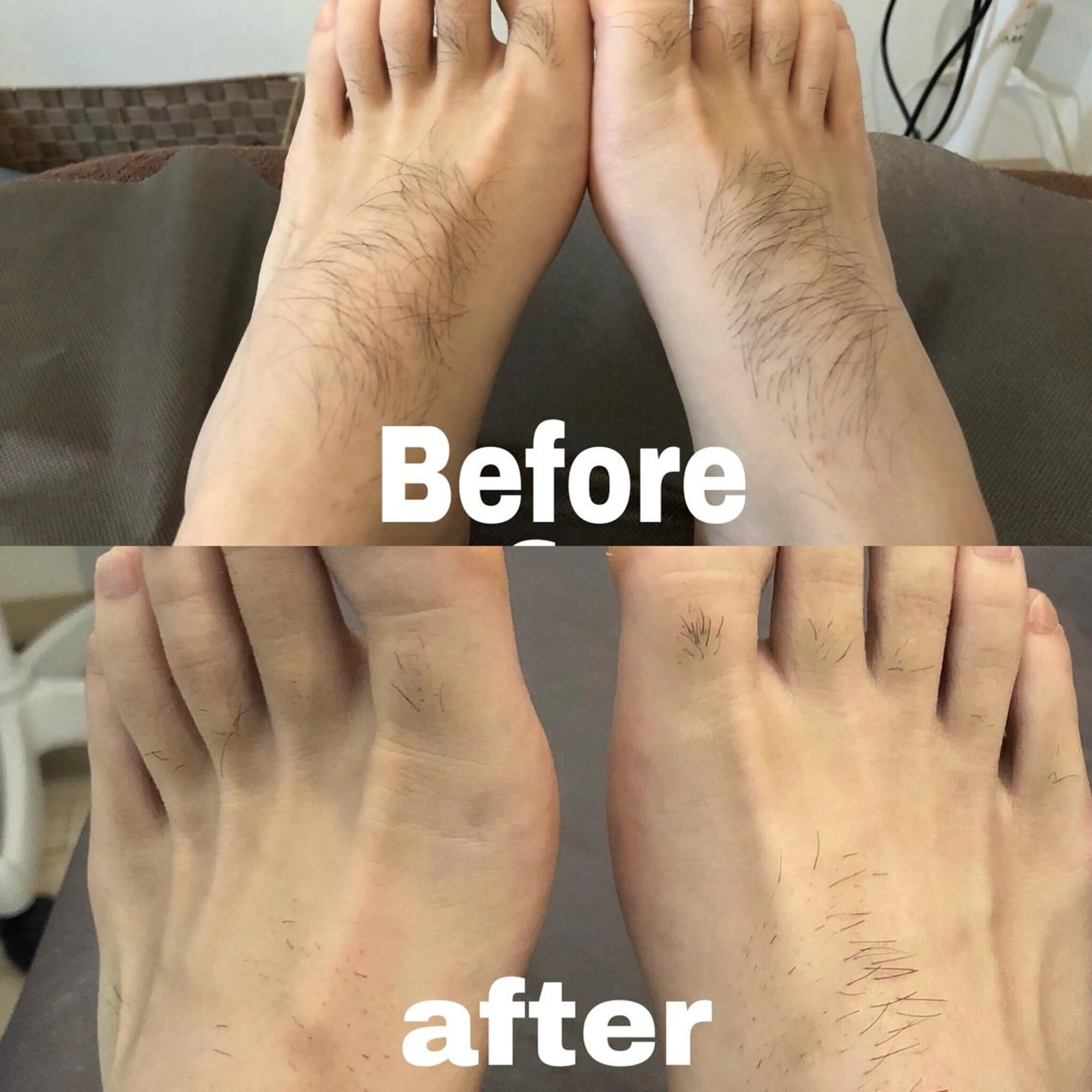 脱毛 芝田 ミチコのエステ・リラクイメージ