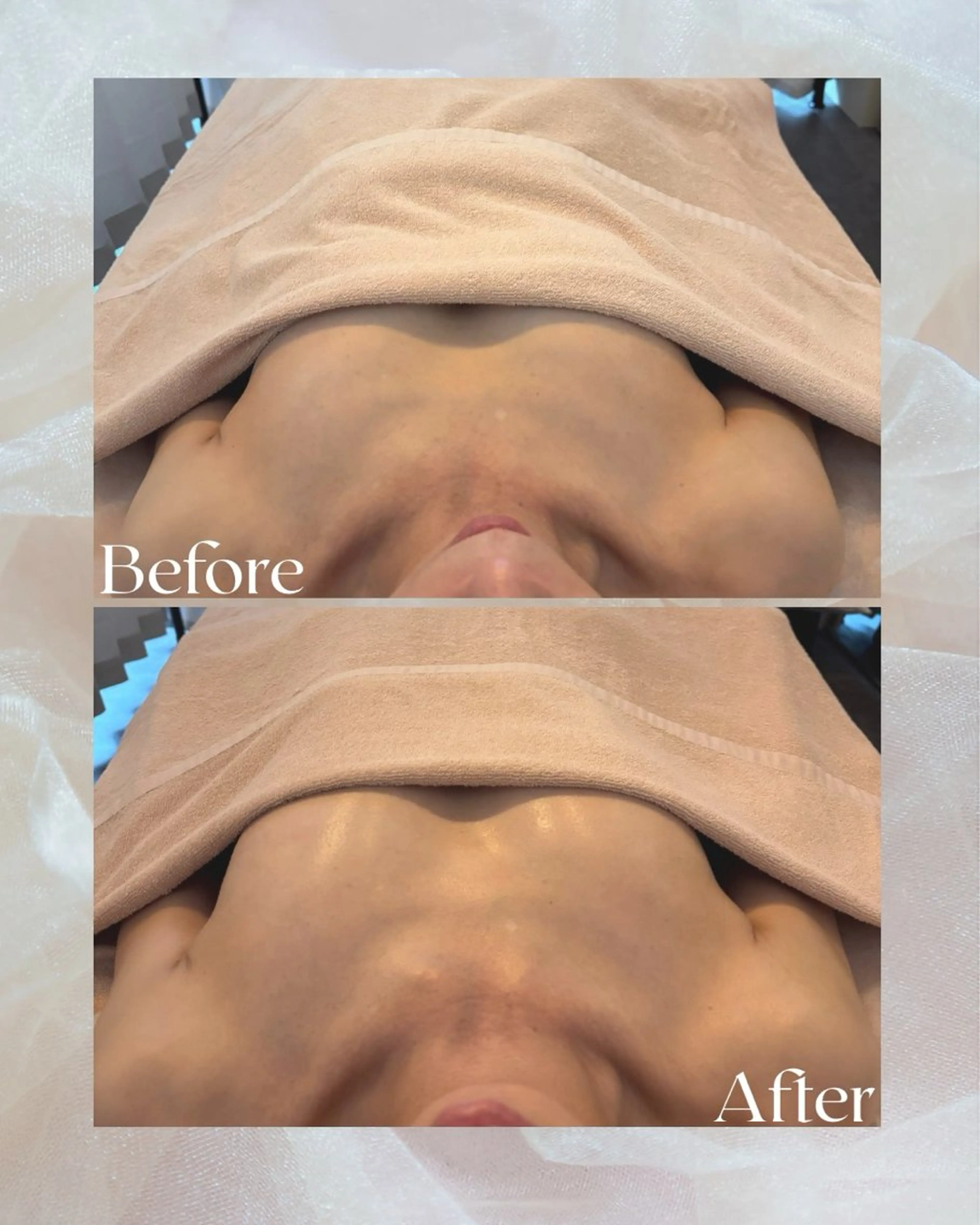 【どなたでも】【プレオープン中の特別価格】90分バストケアトリートメントの写真