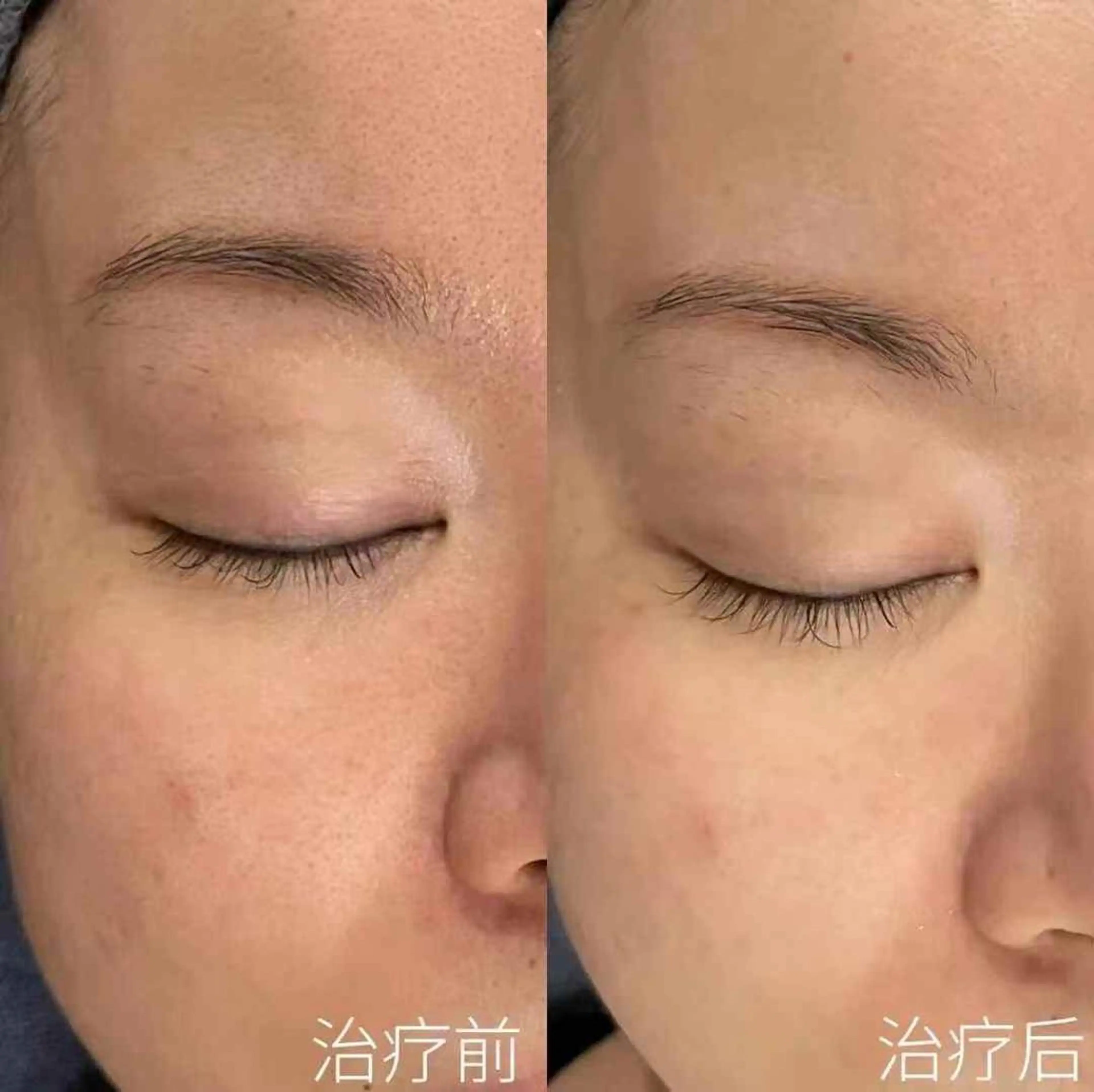 マツエク・マツパ エステ aliaハイフ&水光ジェットサロン所属・aliaハーブ水光店 エステティシャン募集のエステ・リラクイメージ