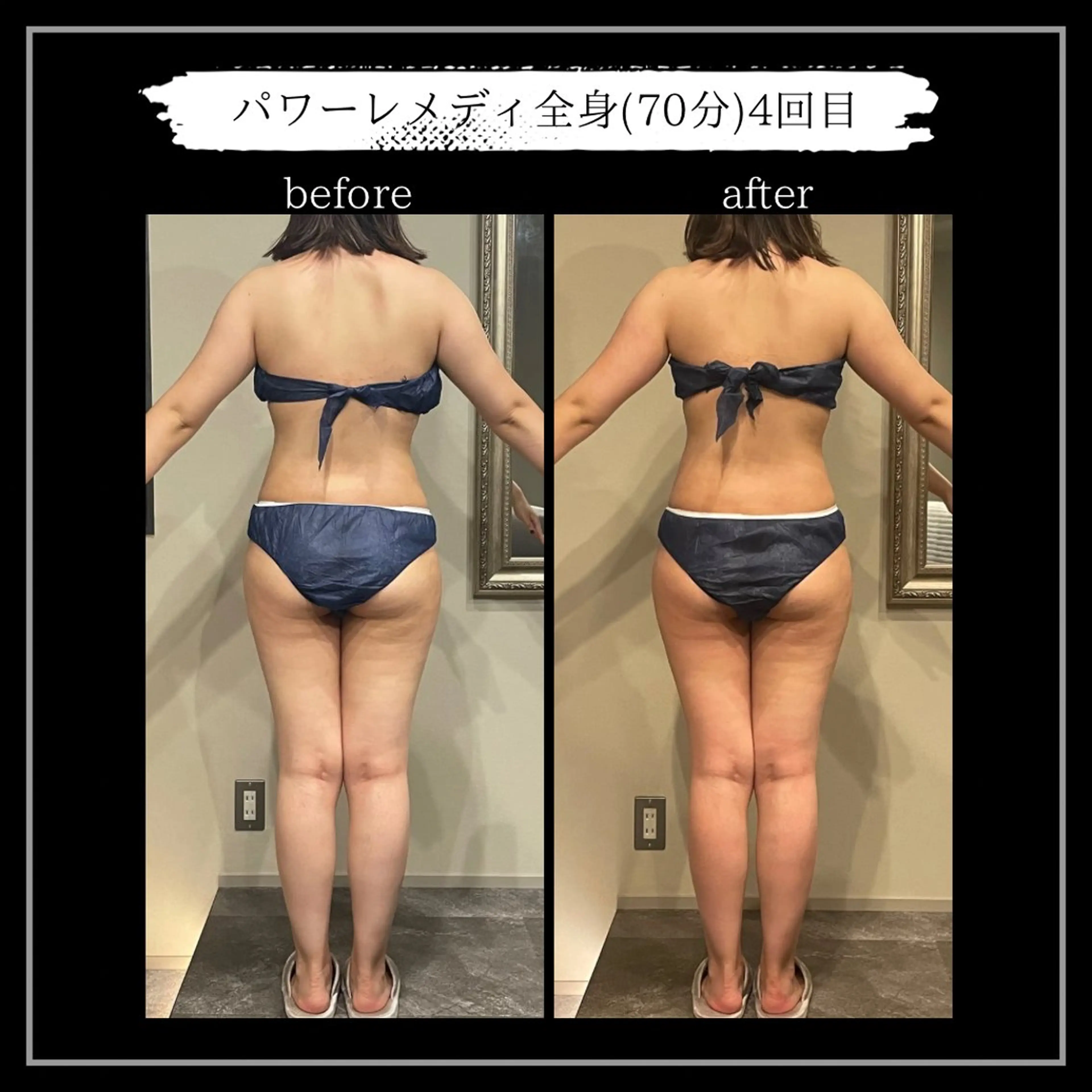 オフ:オン所属・オフ:オン 全身筋膜マッサージのエステ・リラクイメージ