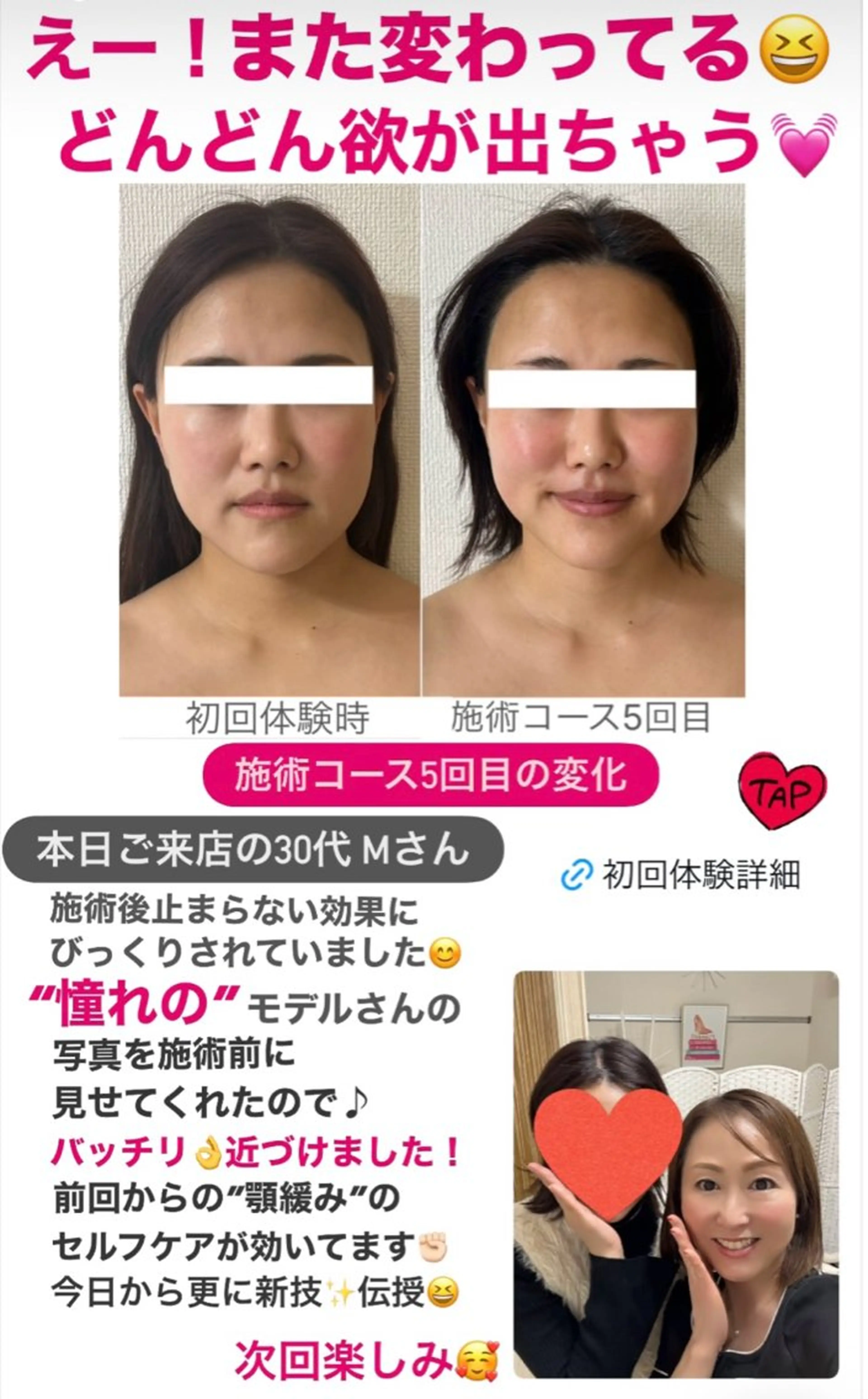 la lumie're (ラ リュミエール)所属・小顔サロン (ラ リュミエール)のエステ・リラクイメージ