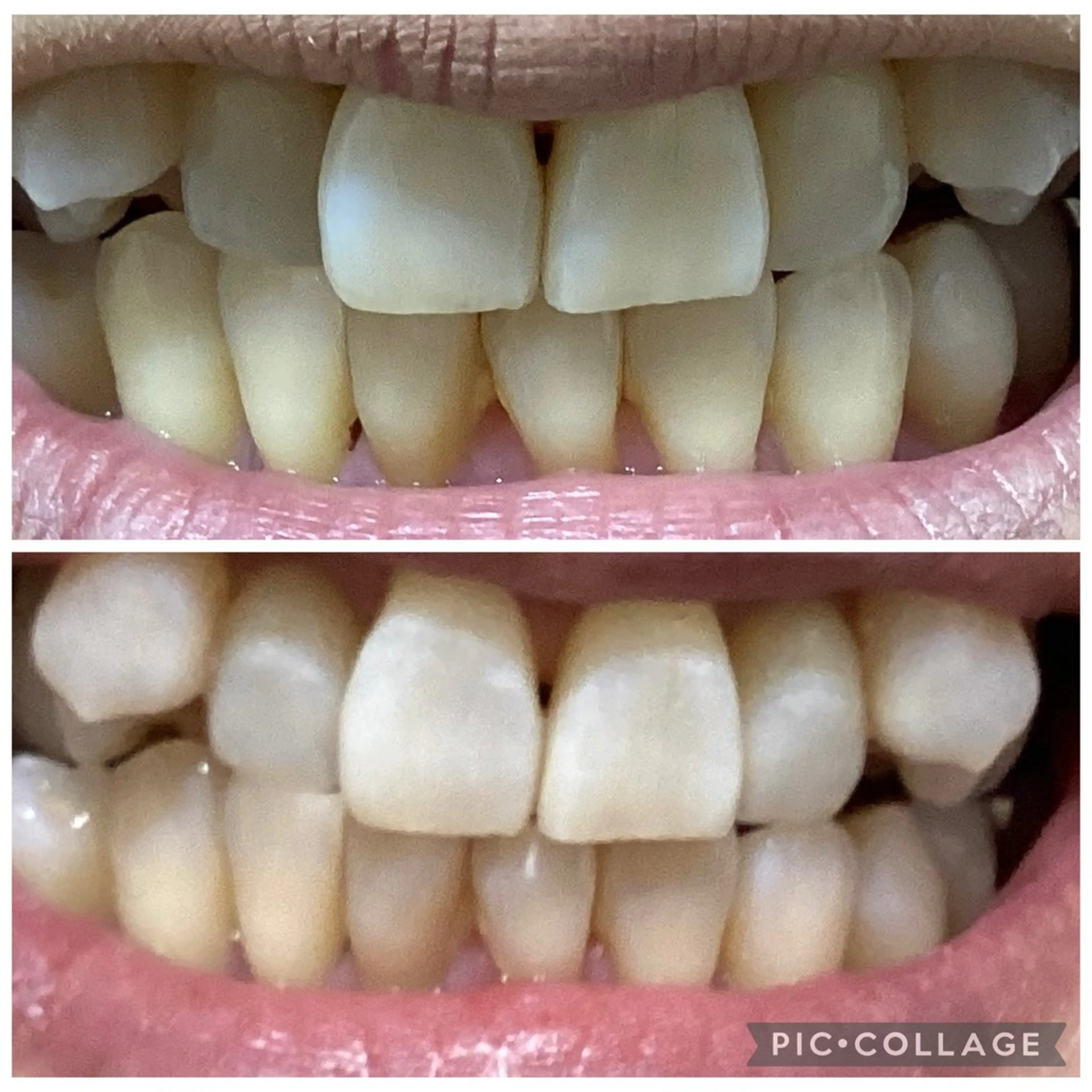 リラク セルフホワイトニングサロン　Betee所属・セルフホワイトニング Beteeのエステ・リラクイメージ