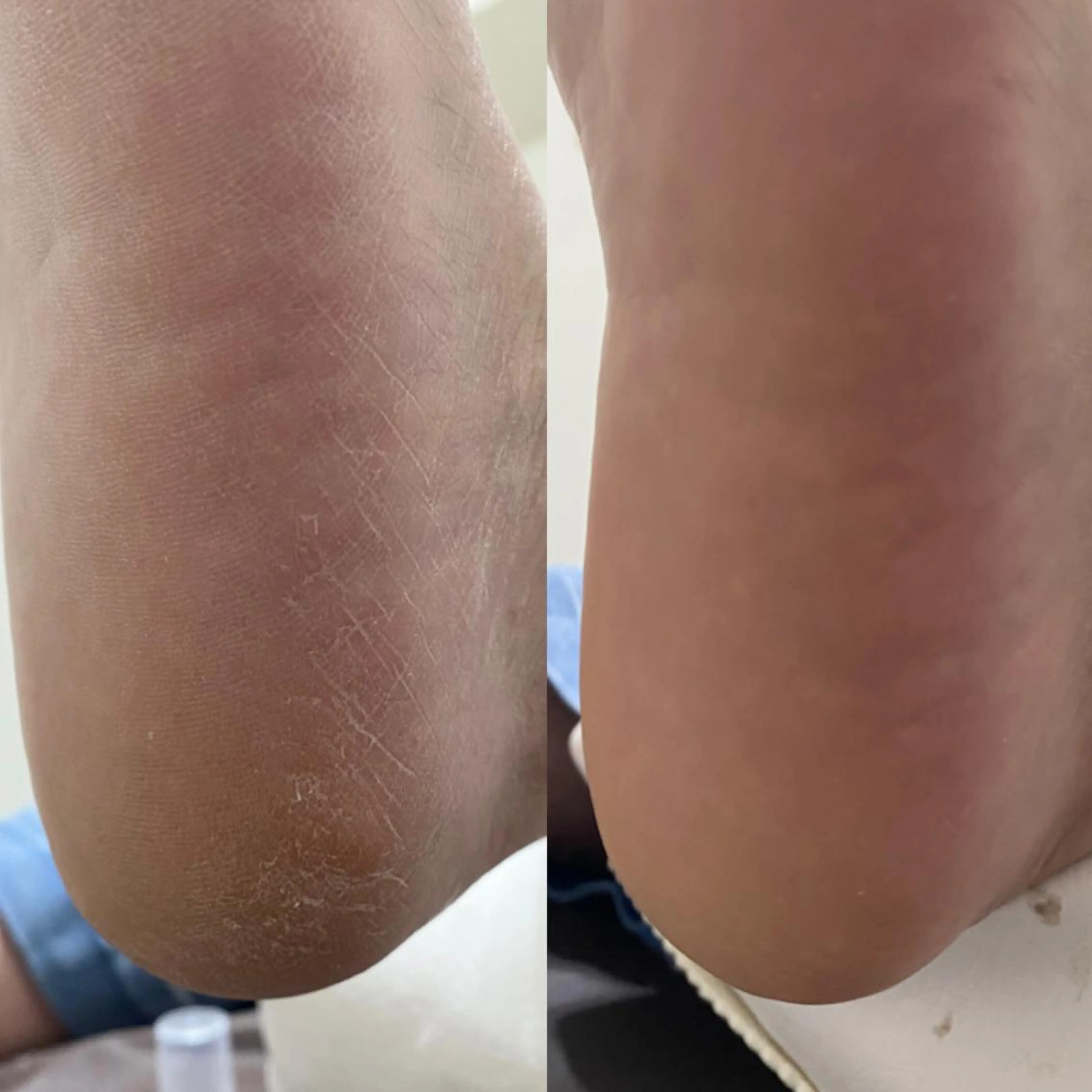 ネイル Rio 𓍼のネイルデザイン