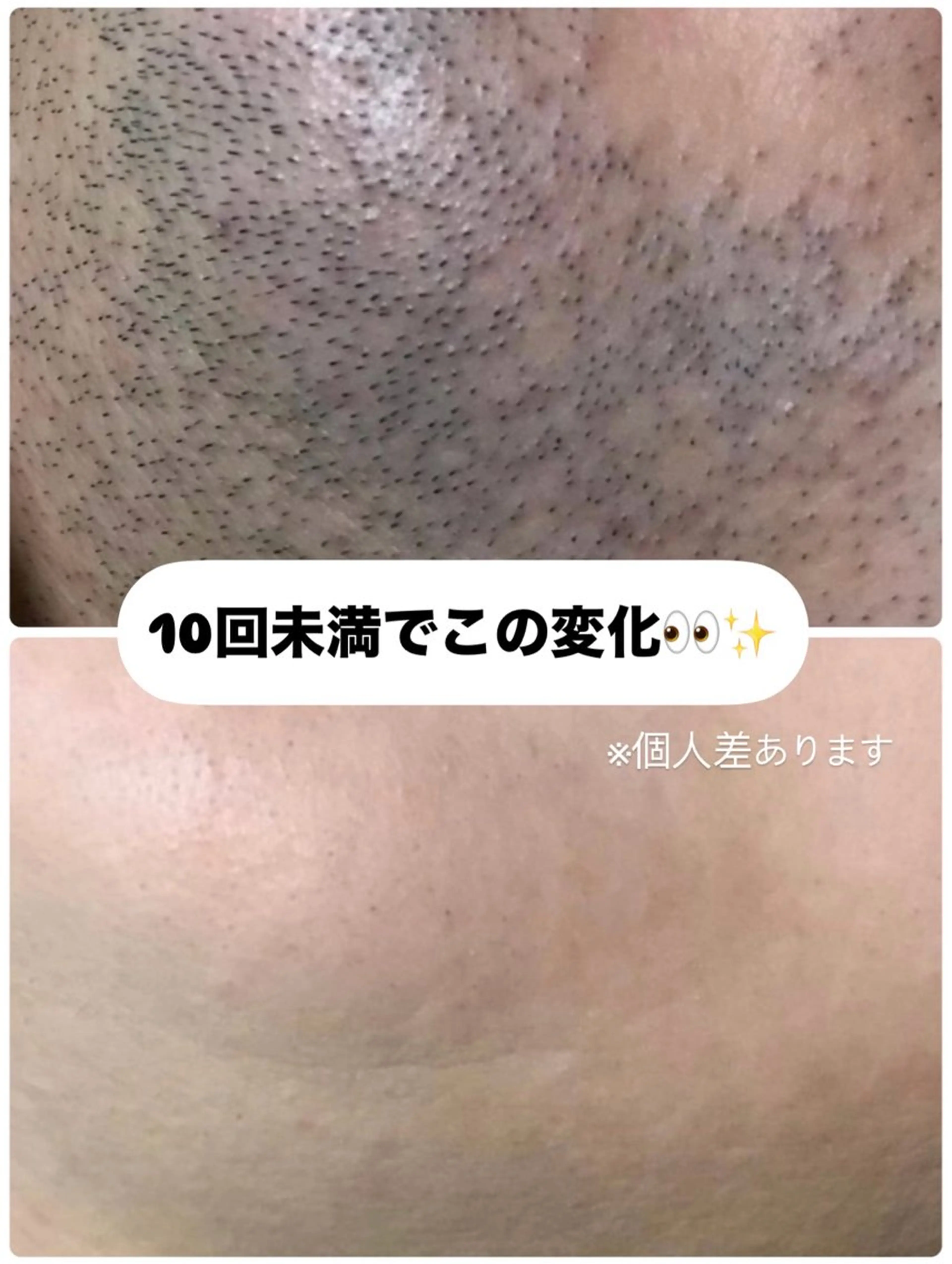 メンズ muumo所属・muumo まりののエステ・リラクイメージ