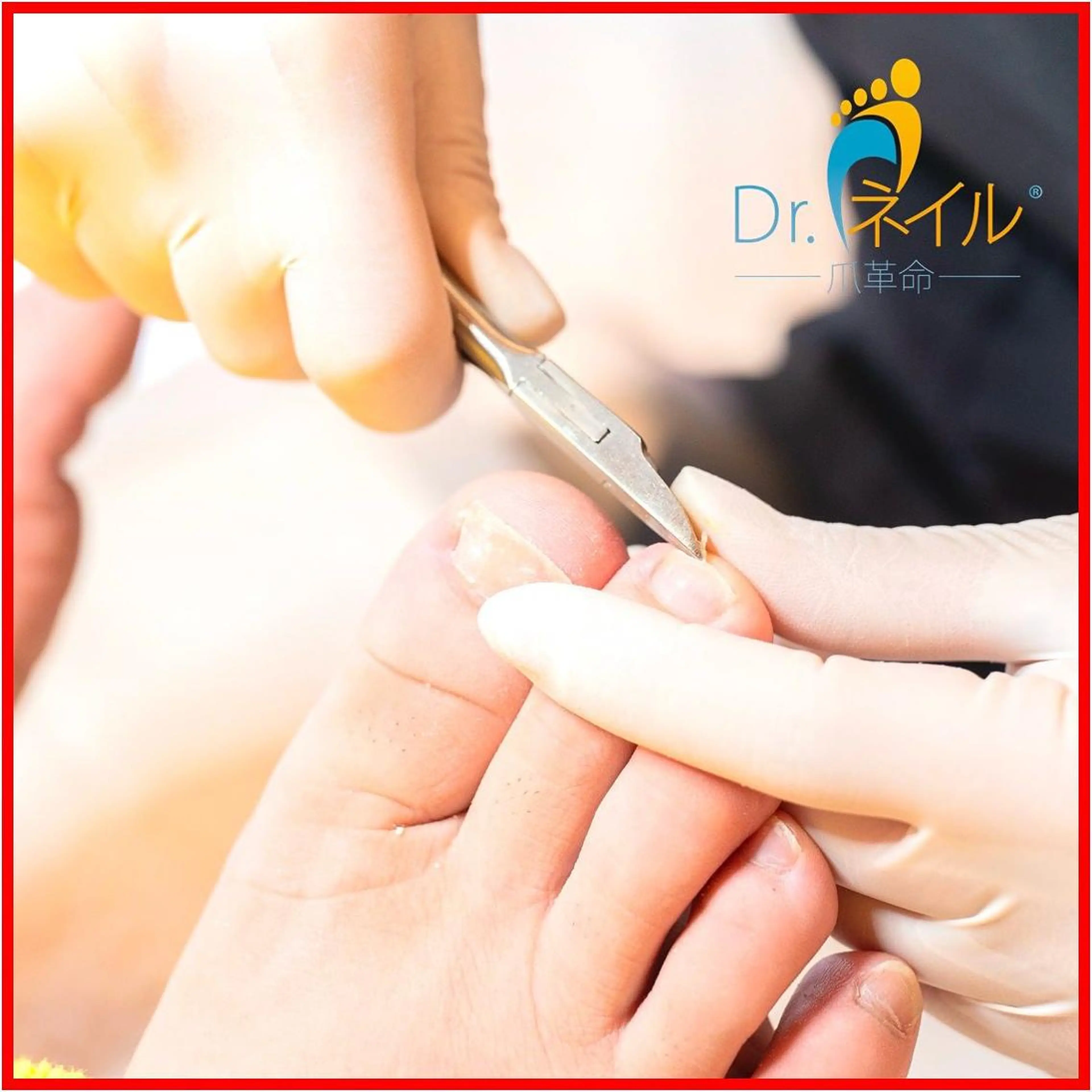 【Quickフットケア】クイック足爪カットの写真