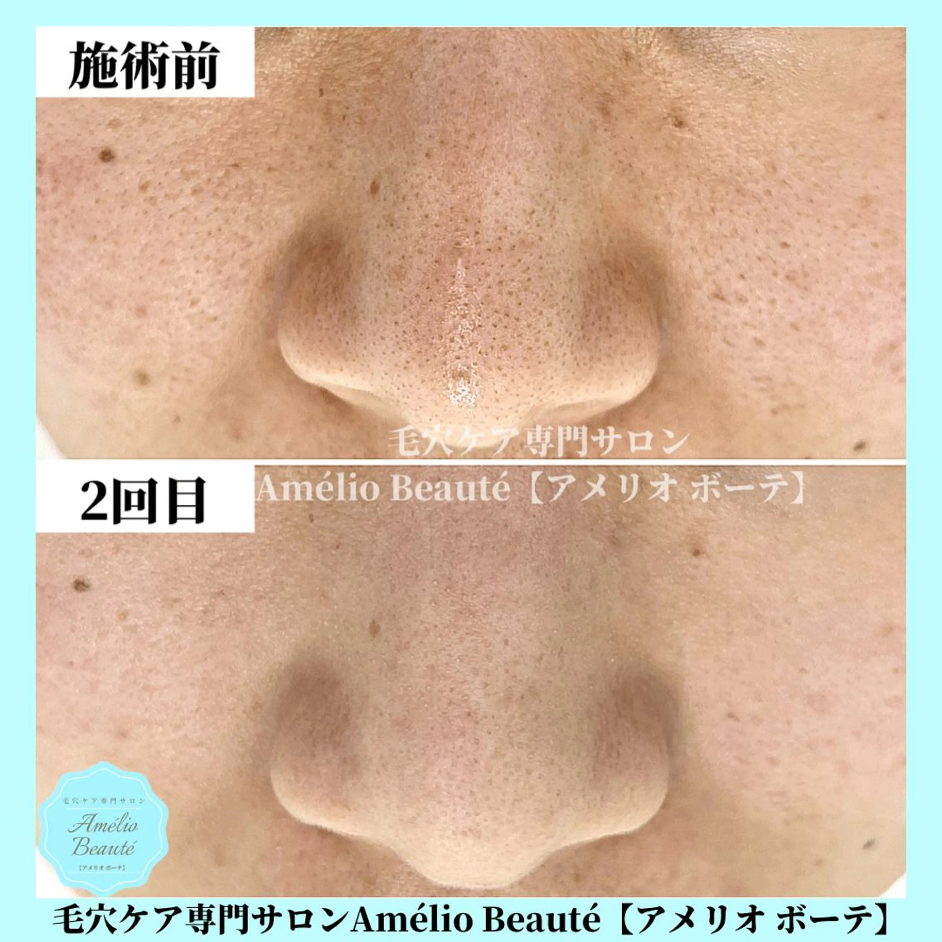 毛穴ケア専門サロン Amélio Beauté所属・毛穴ケア専門サロン アメリオボーテのその他イメージ