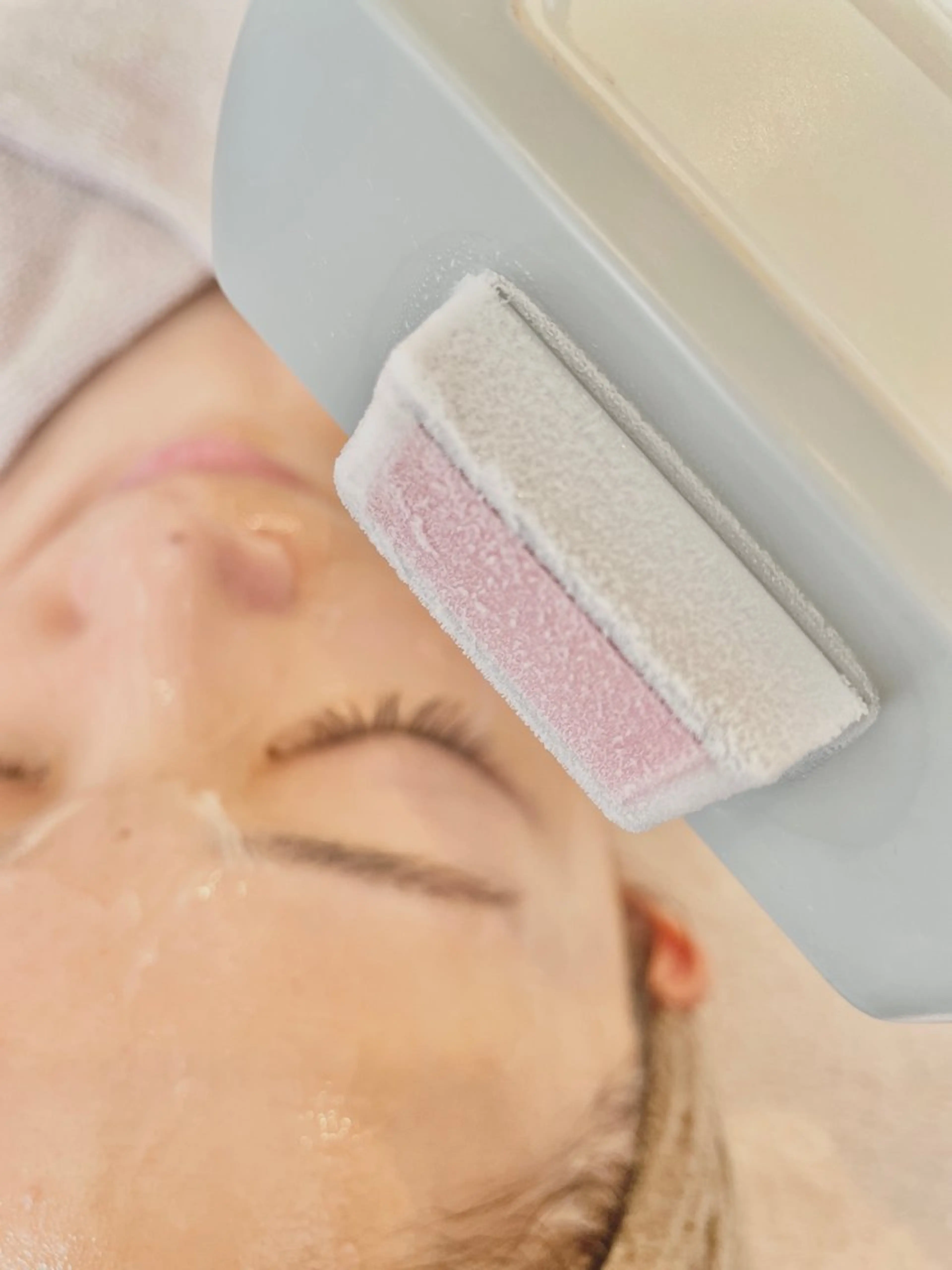 【 毛穴/乾燥/脱毛 】全顔脱毛＋ディープクレンジング＋高保湿ケアパックの写真