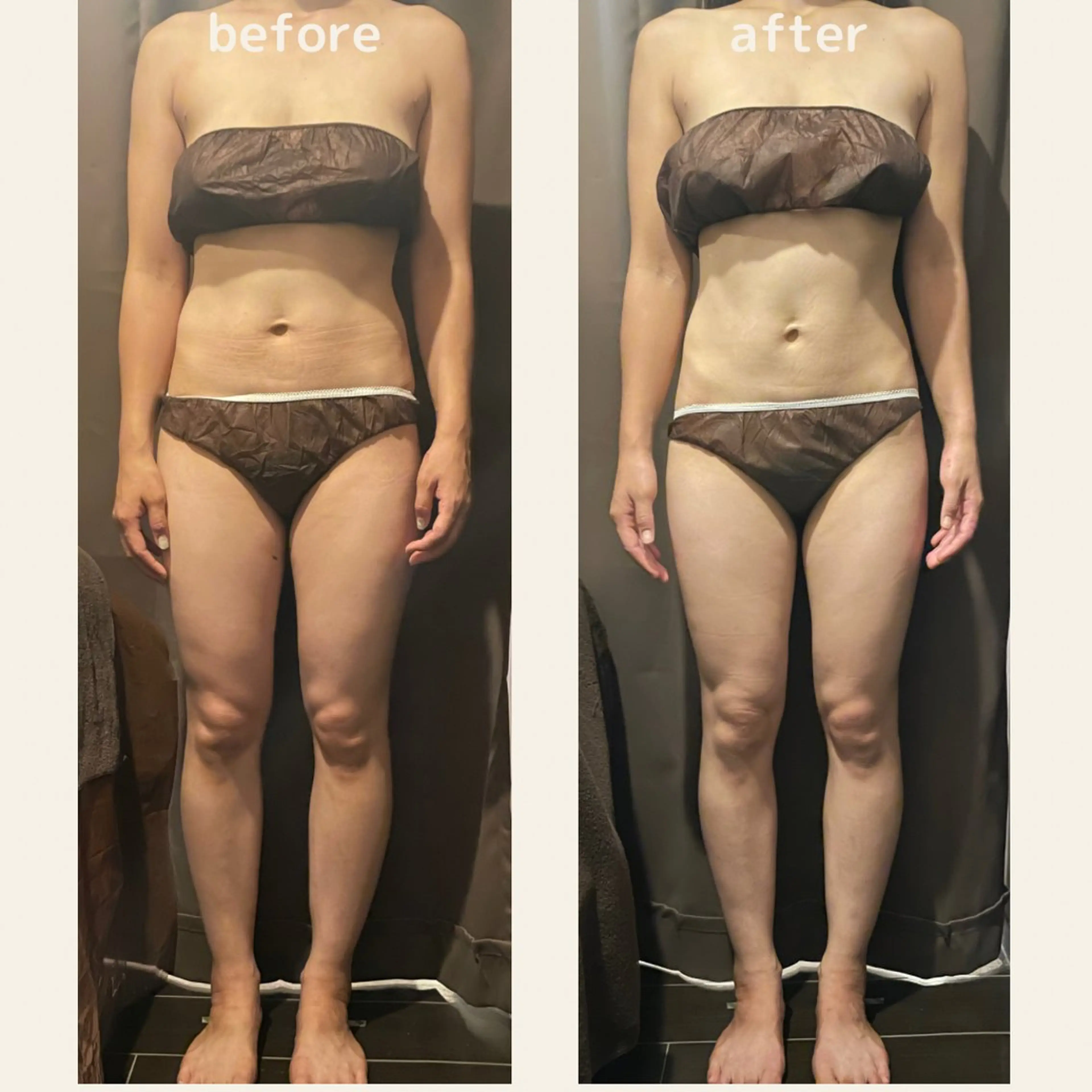 エステ 痩身・フェイシャル/if  byOrabriller所属・if byOrab riller【ｲﾌ】のその他イメージ