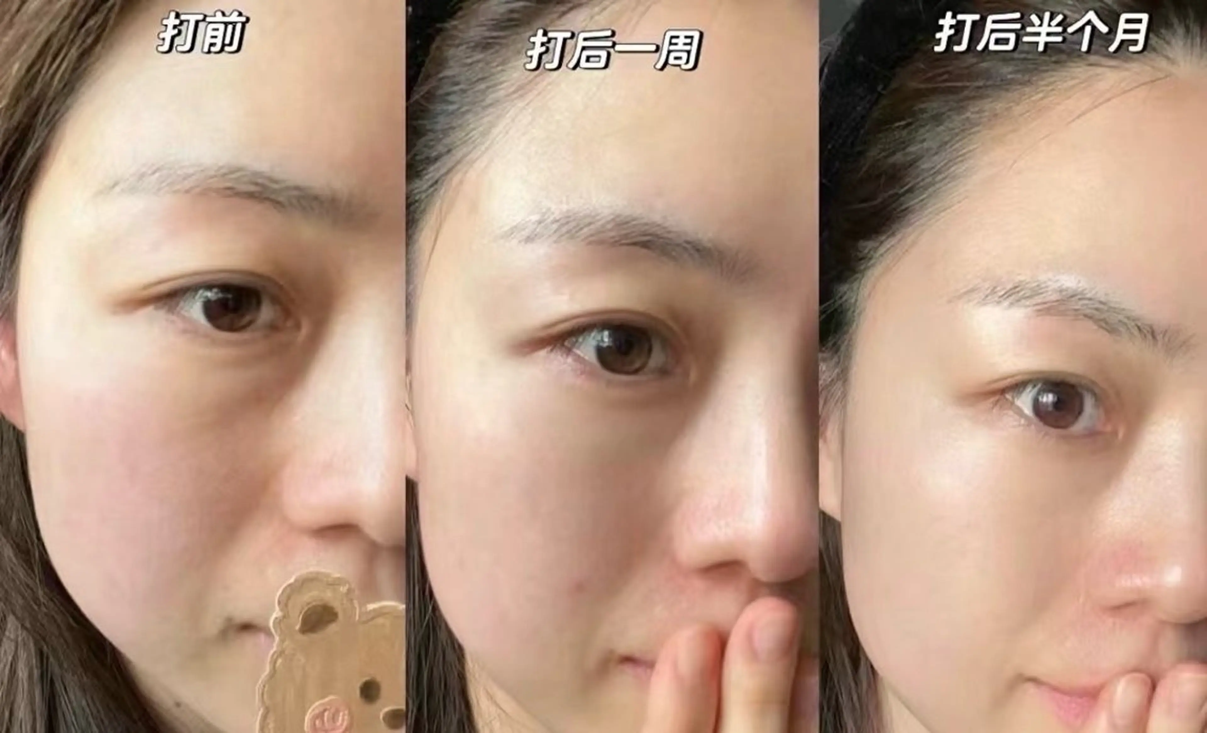 ネイル エステ 愛維美水光美肌専門店所属・愛維美水光美肌専門店 メンズレディースokのエステ・リラクイメージ