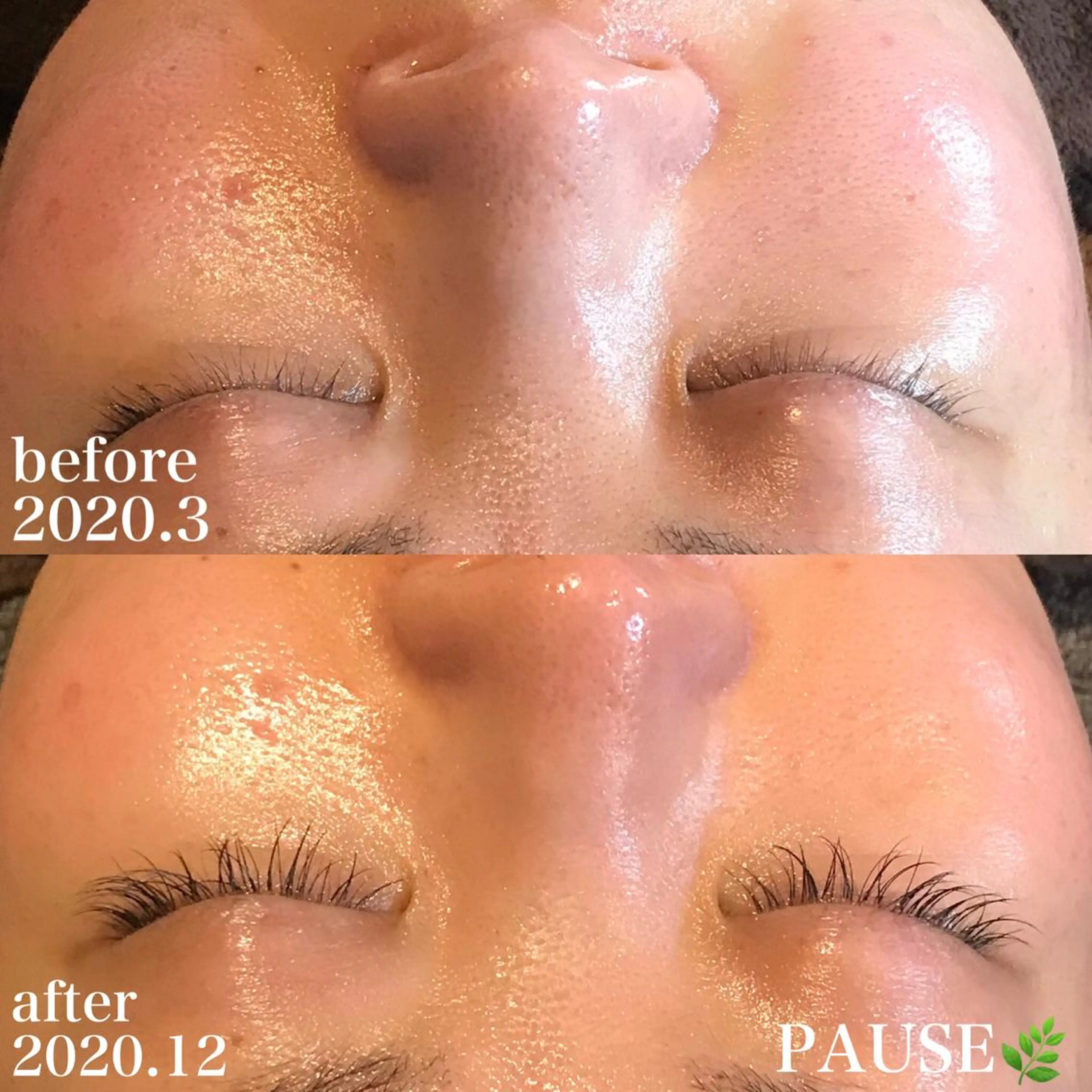 エステ 浜野 恵美のエステ・リラクイメージ