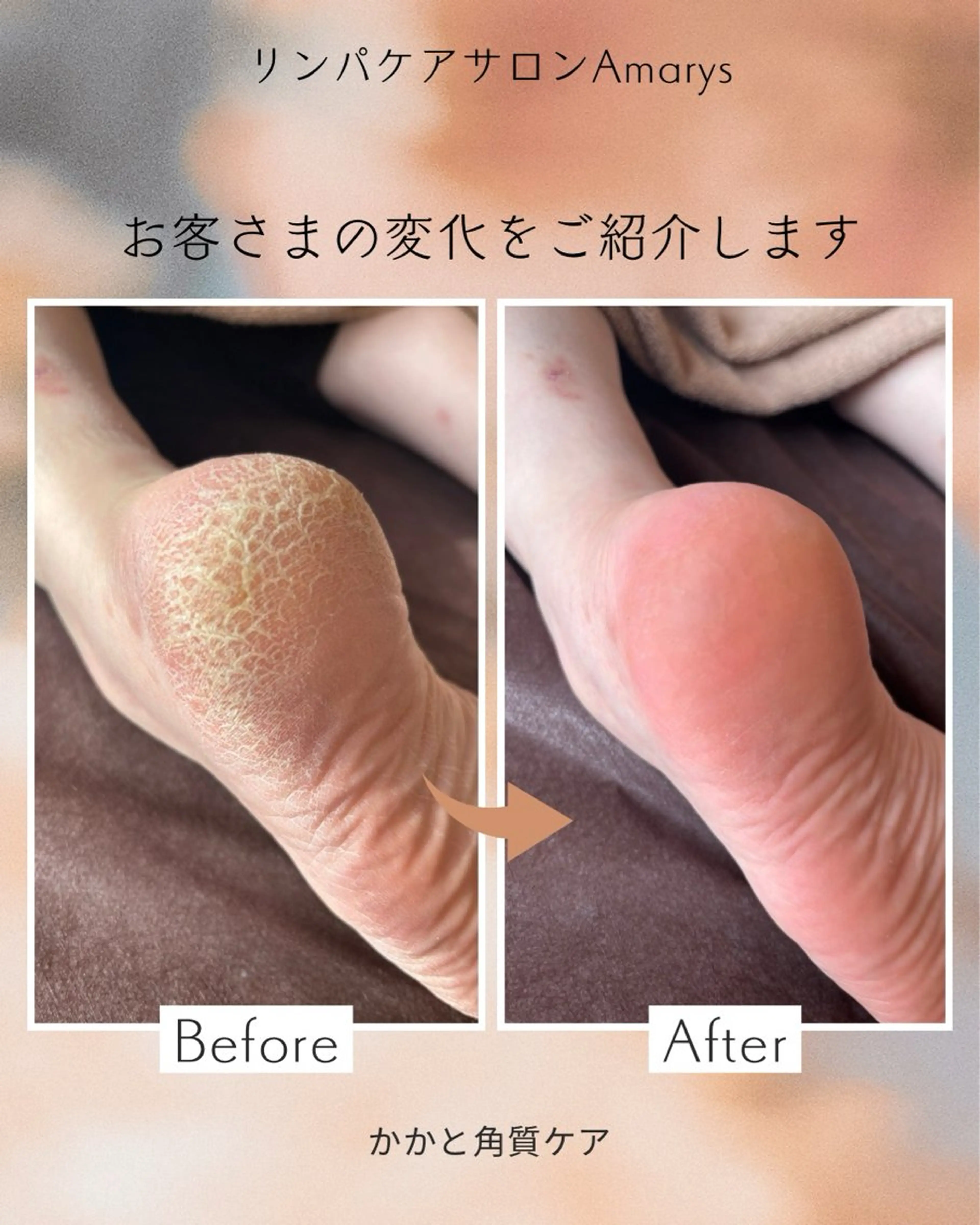 リラク Amarys アマリスのエステ・リラクイメージ