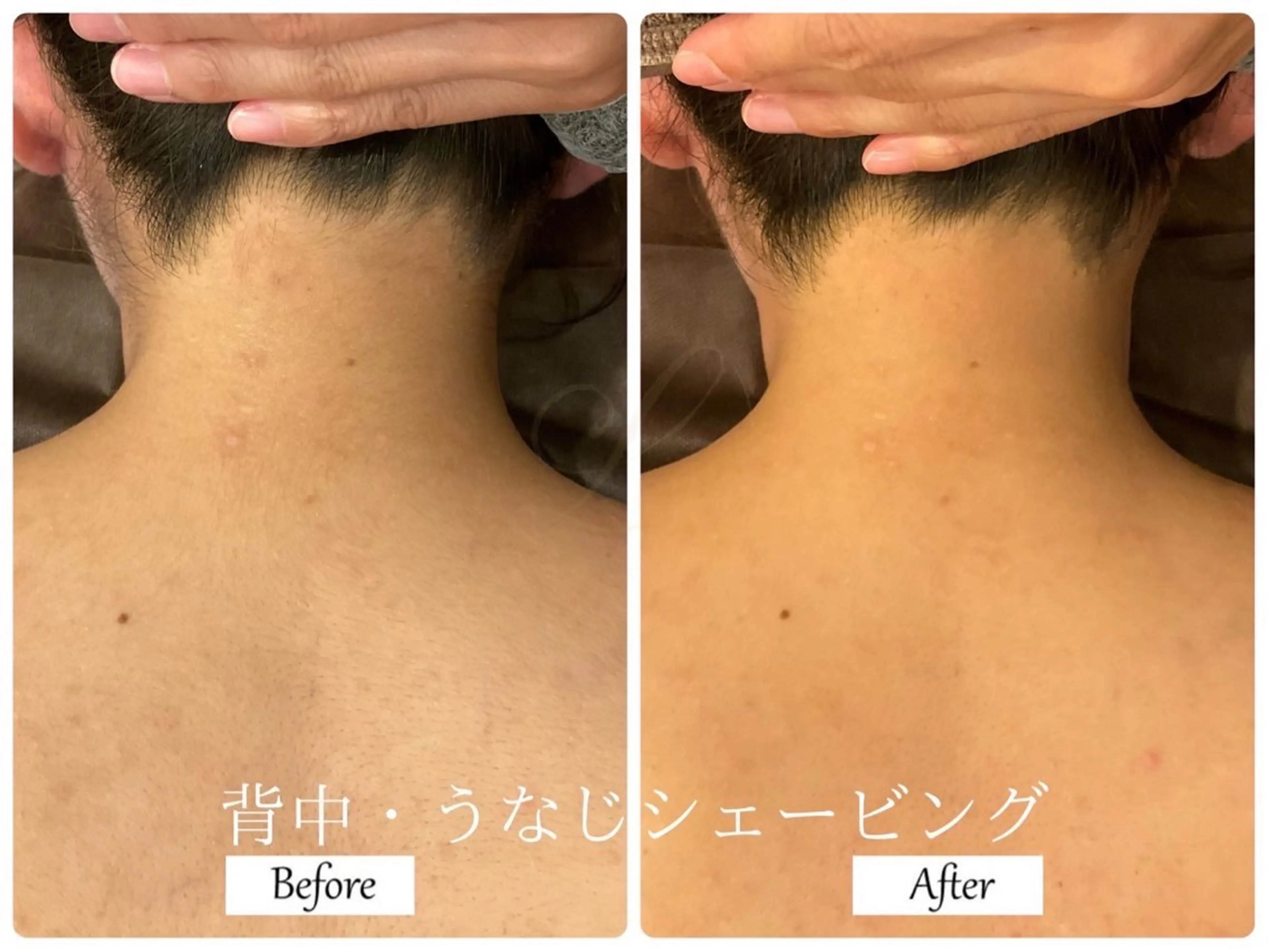 その他 Beauty  salon Lino所属・🎀うなじ脱毛🎀 ㅣLino堀江のエステ・リラクイメージ