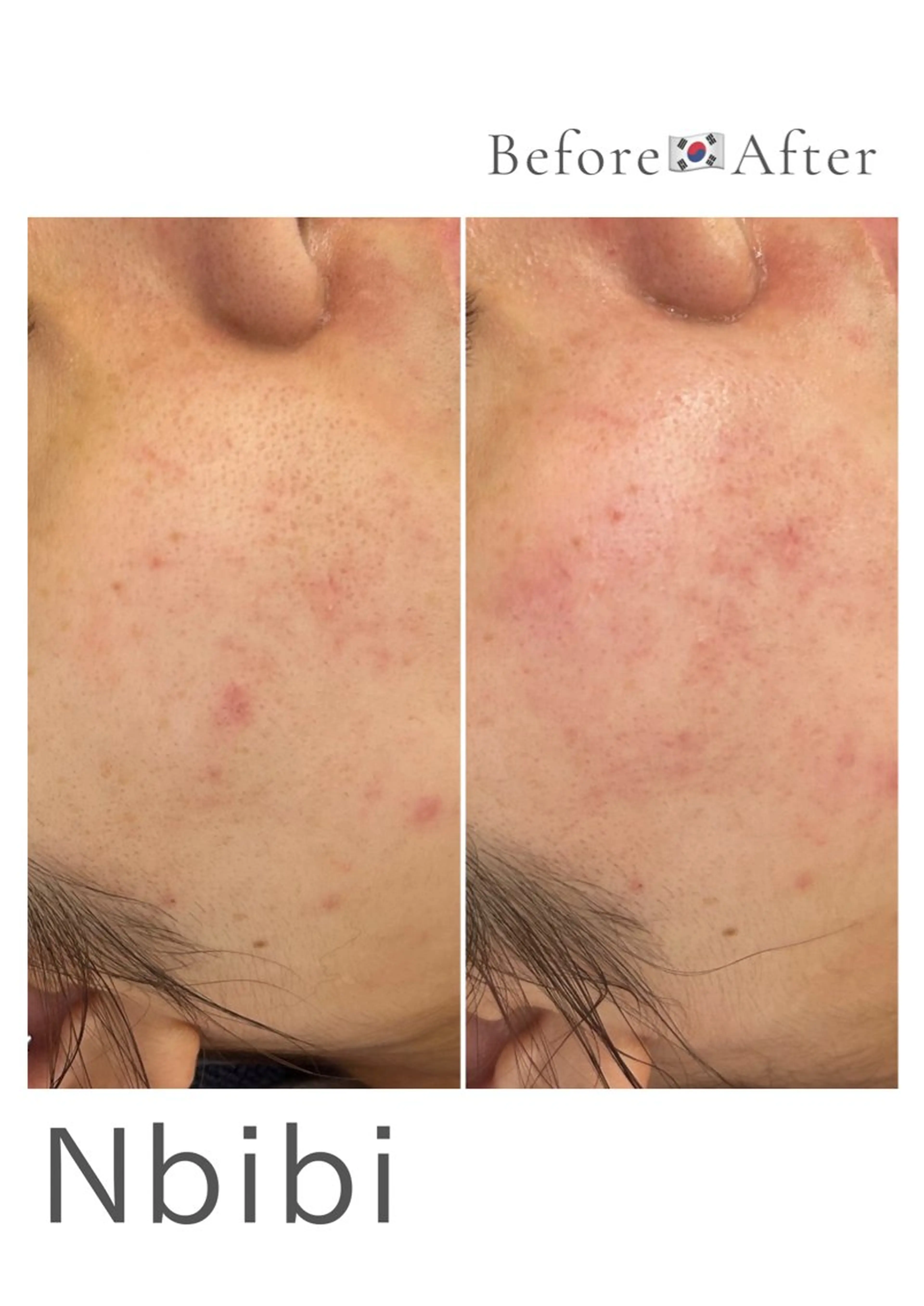 韓国🇰🇷価格 サロン_Nbibiのエステ・リラクイメージ