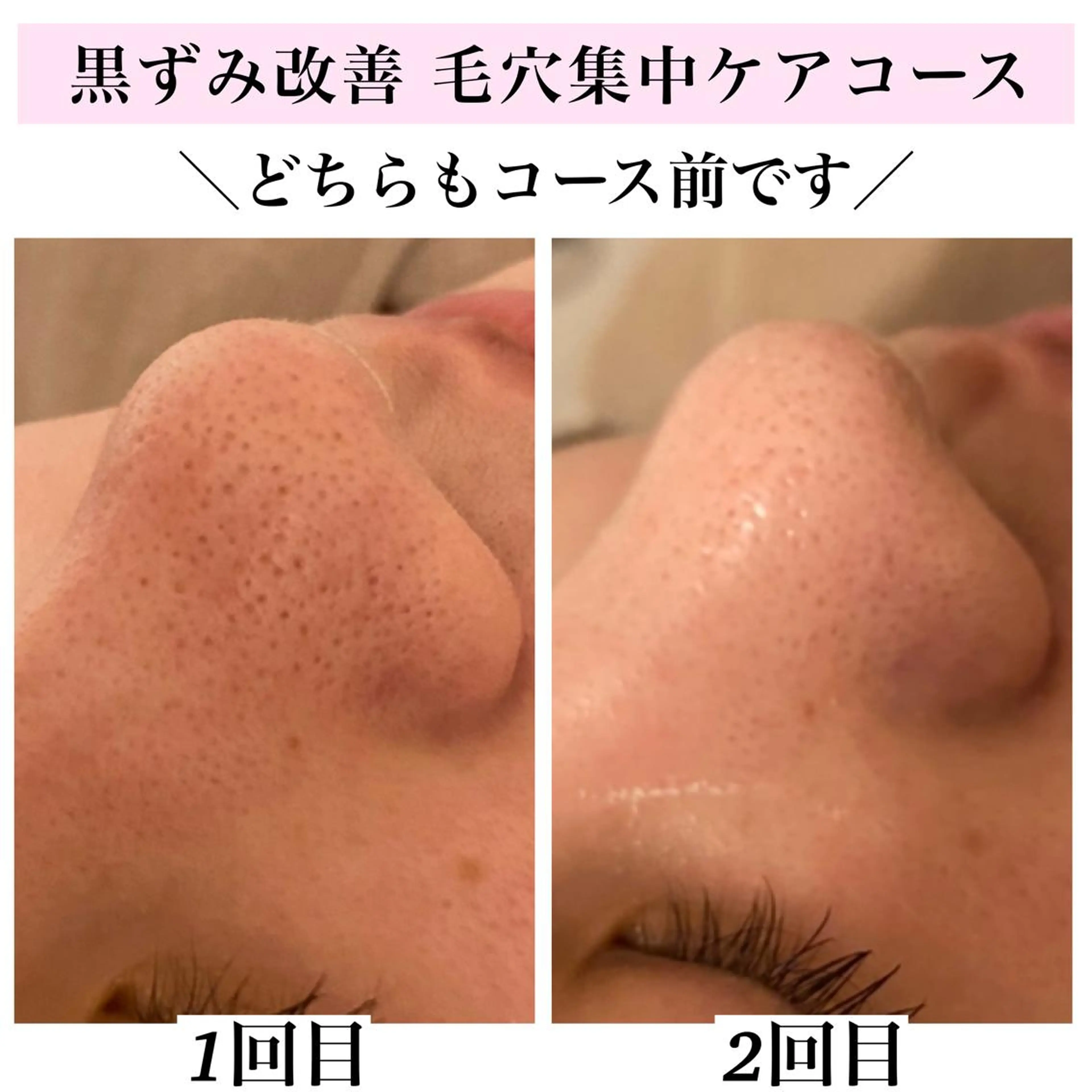 エステ リラク Bellesthe （ベルエステ）のエステ・リラクイメージ