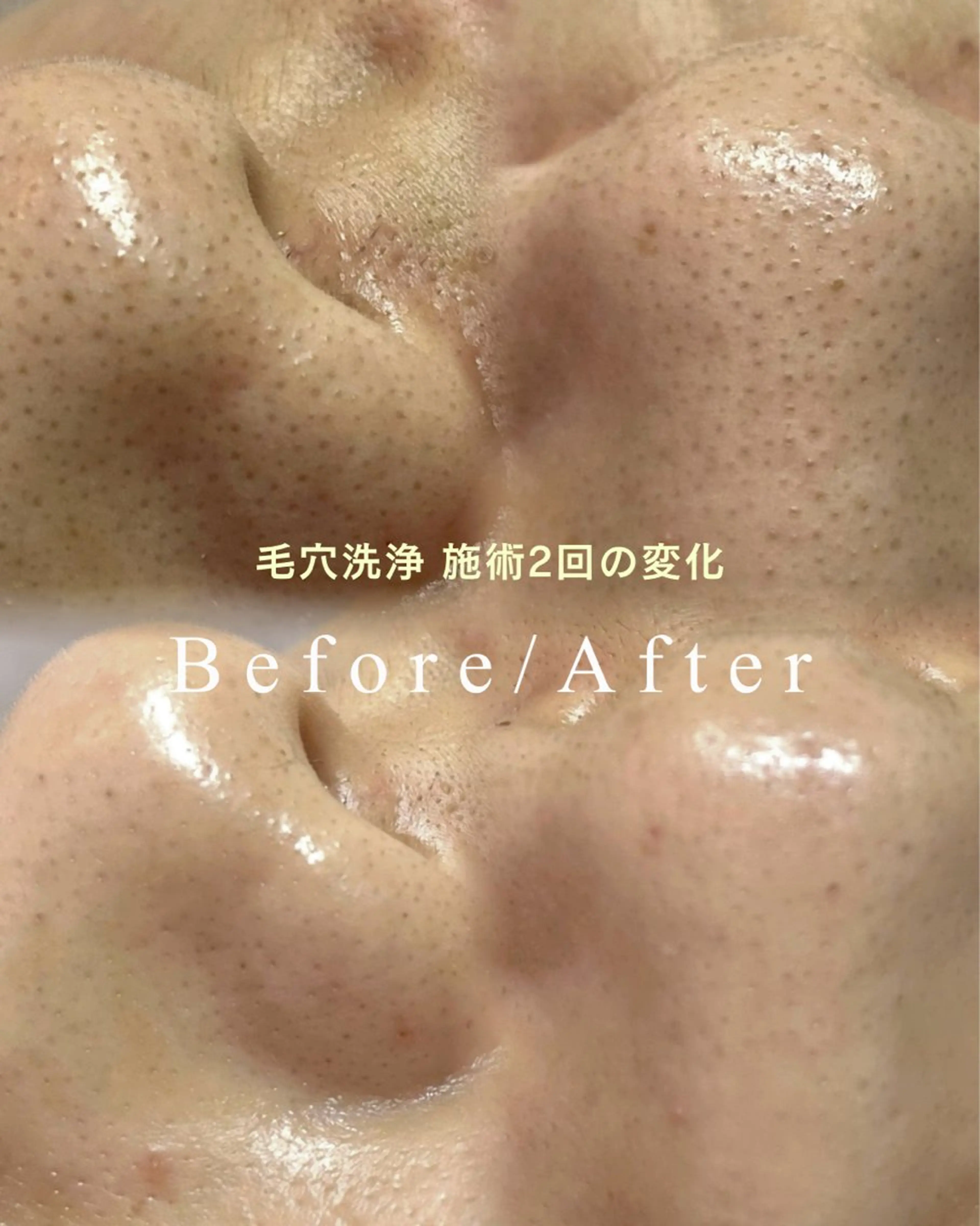 cherir所属・cherir大井町/ 毛穴ニキビ改善専門のエステ・リラクイメージ