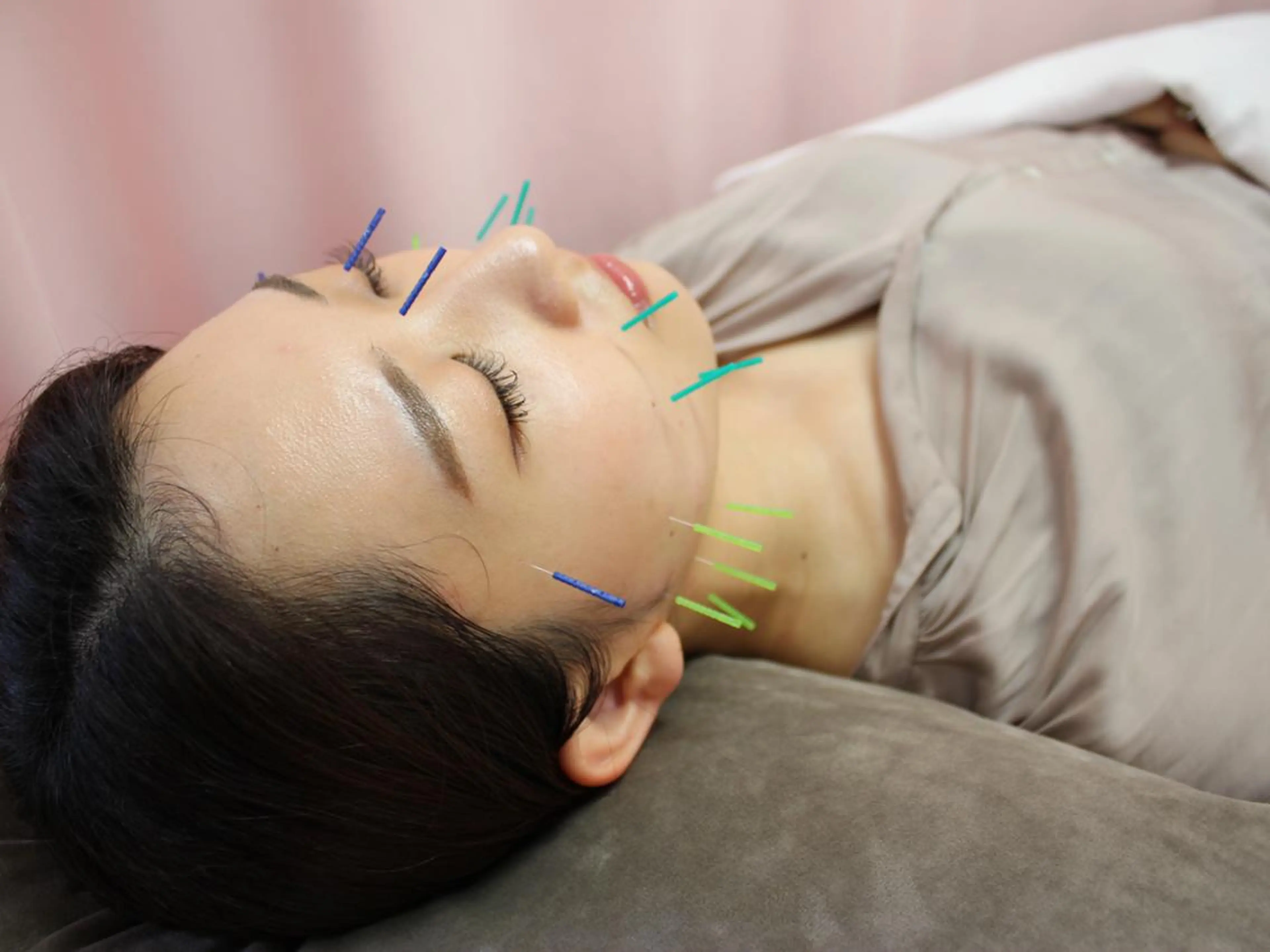 エステ リラク 同心整骨院 美容鍼・整体・小顔のエステ・リラクイメージ