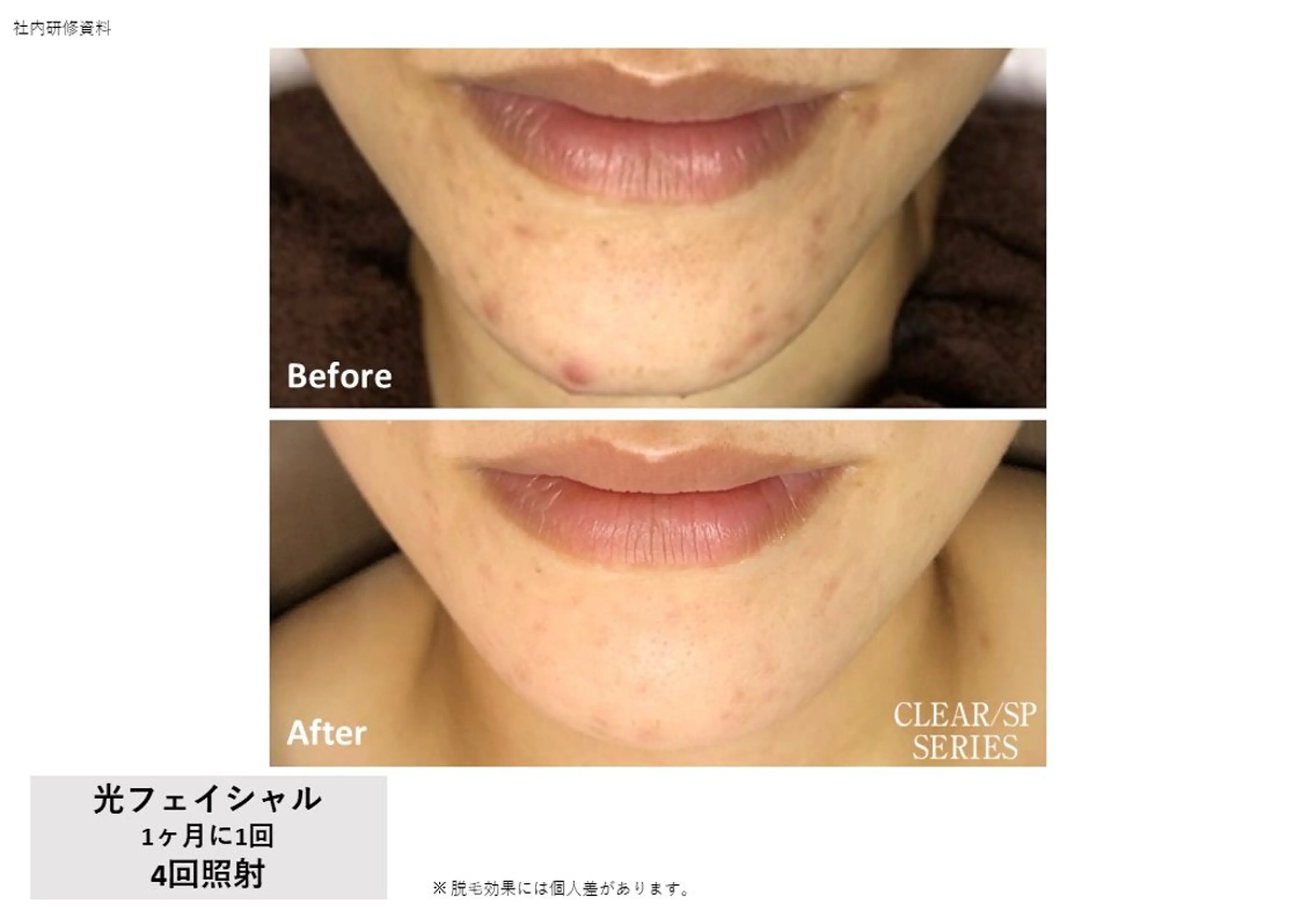 VIERU YURIのネイルデザイン