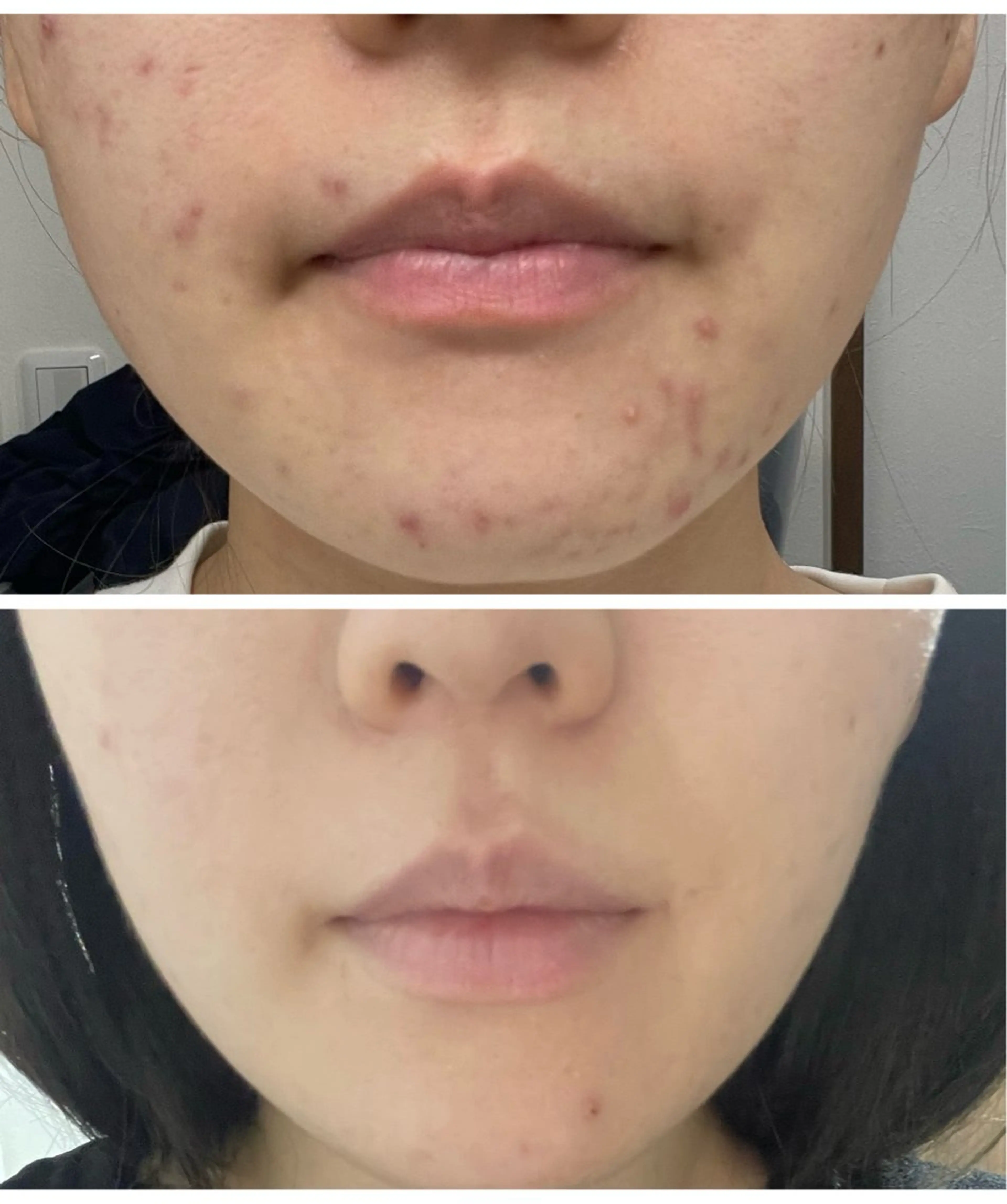 エステ Le Cherien所属・姫路/肌管理/脱毛 Le Cherienのその他イメージ