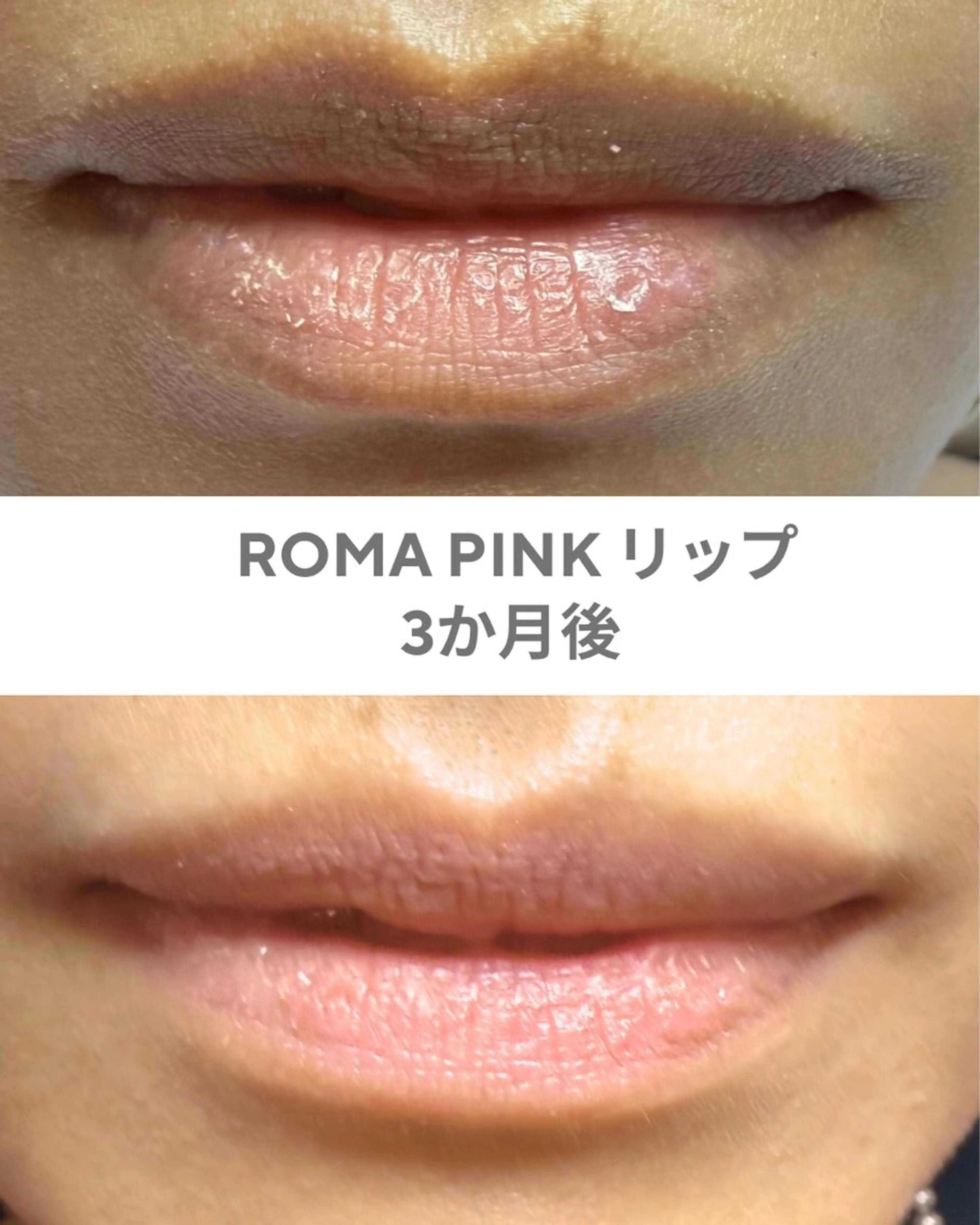 GrandAzure 大人の肌改善のエステ・リラクイメージ