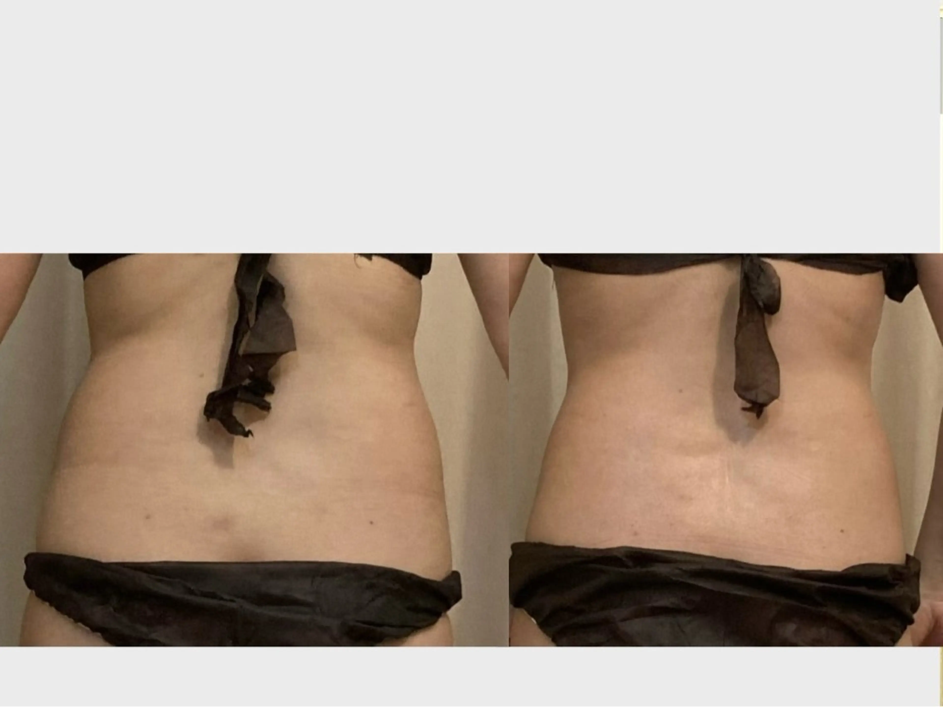 エステ 痩身•小顔•ツヤ肌 810神戸元町店のエステ・リラクイメージ