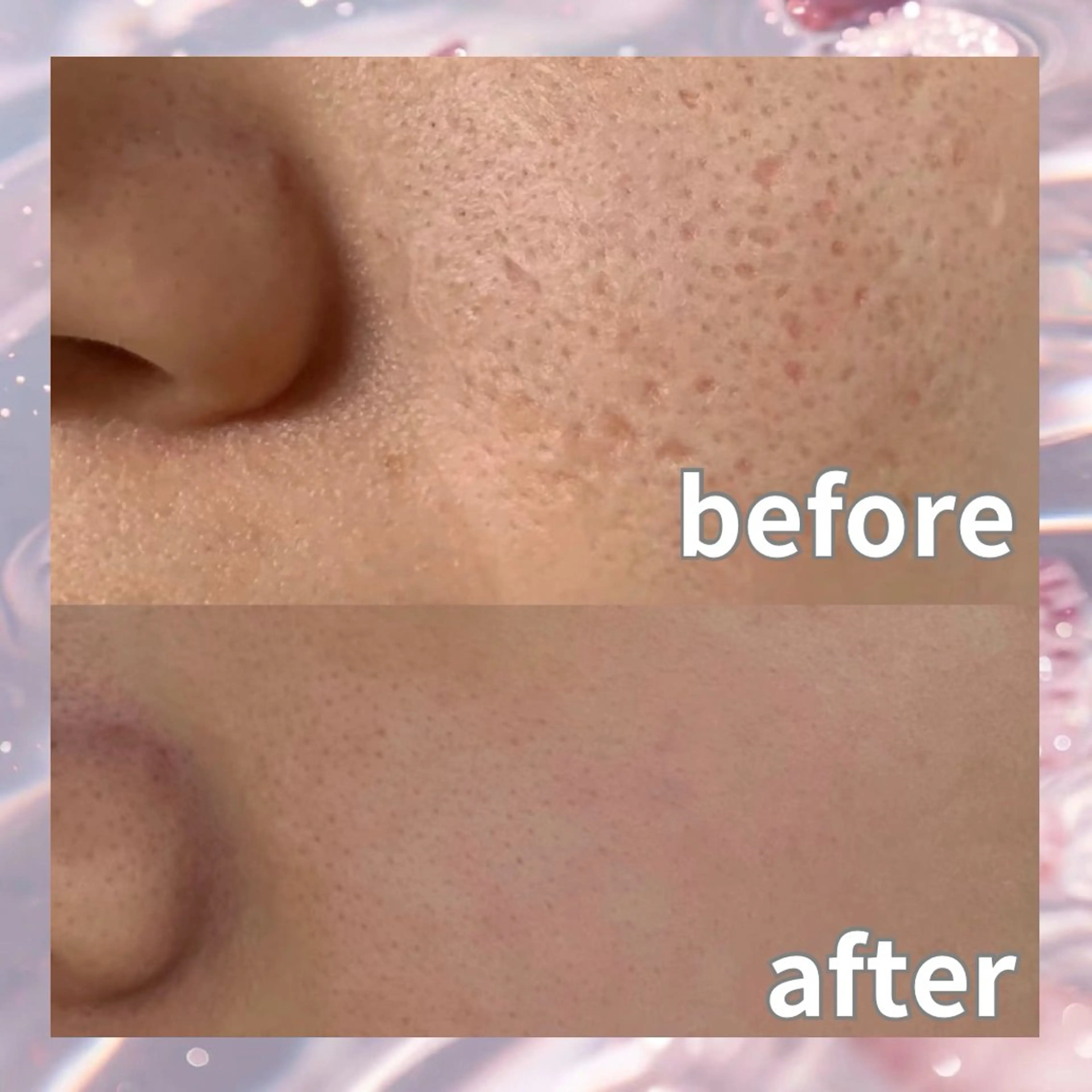 パーマ エステ リラク 愛維美水光美肌専門店所属・愛維美水光美肌専門店 メンズレディースokのエステ・リラクイメージ