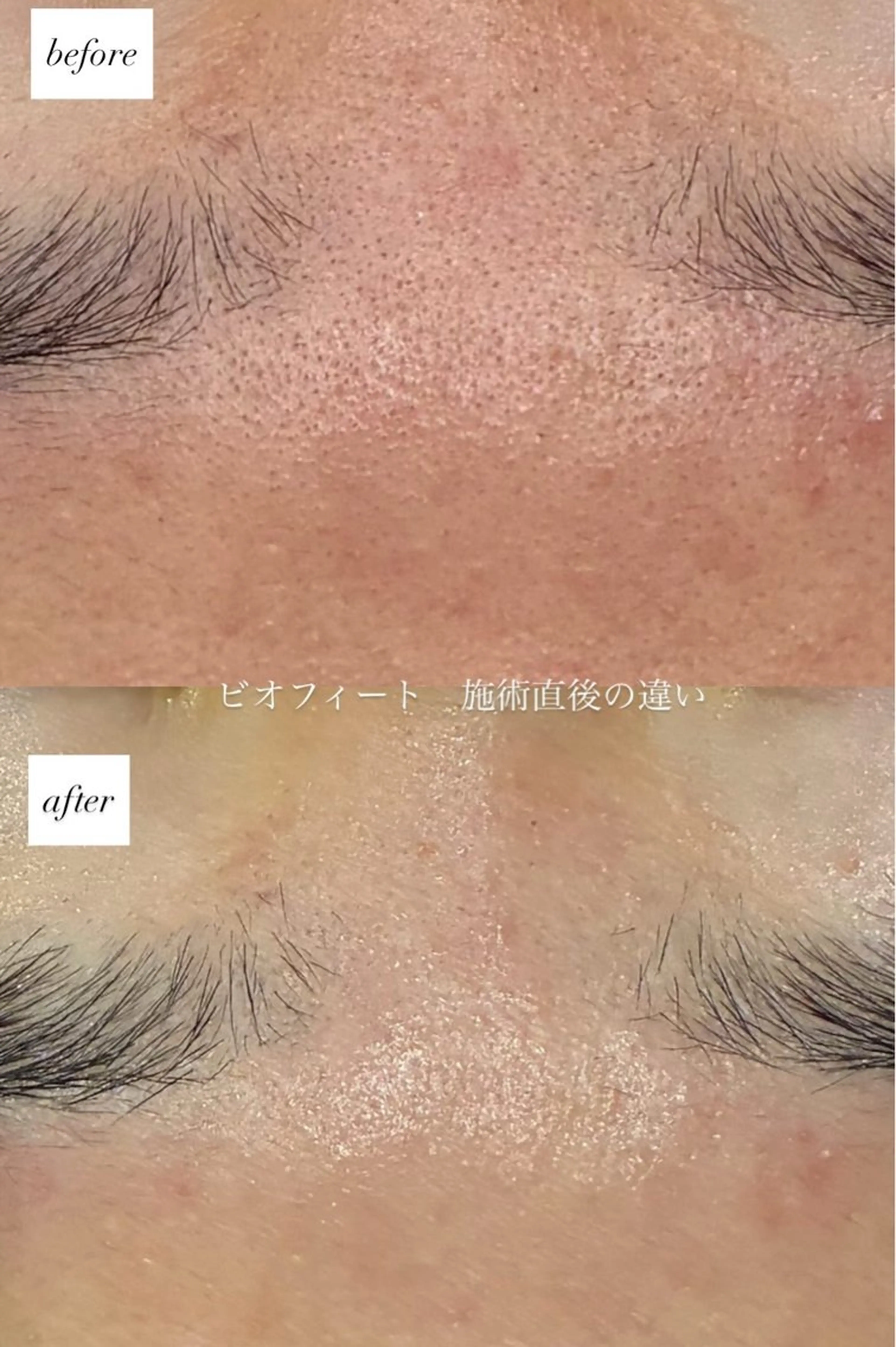 エステ DahliaBeauty ダリアビューティー所属・DahliaBeau tyフェイシャル中村のエステ・リラクイメージ