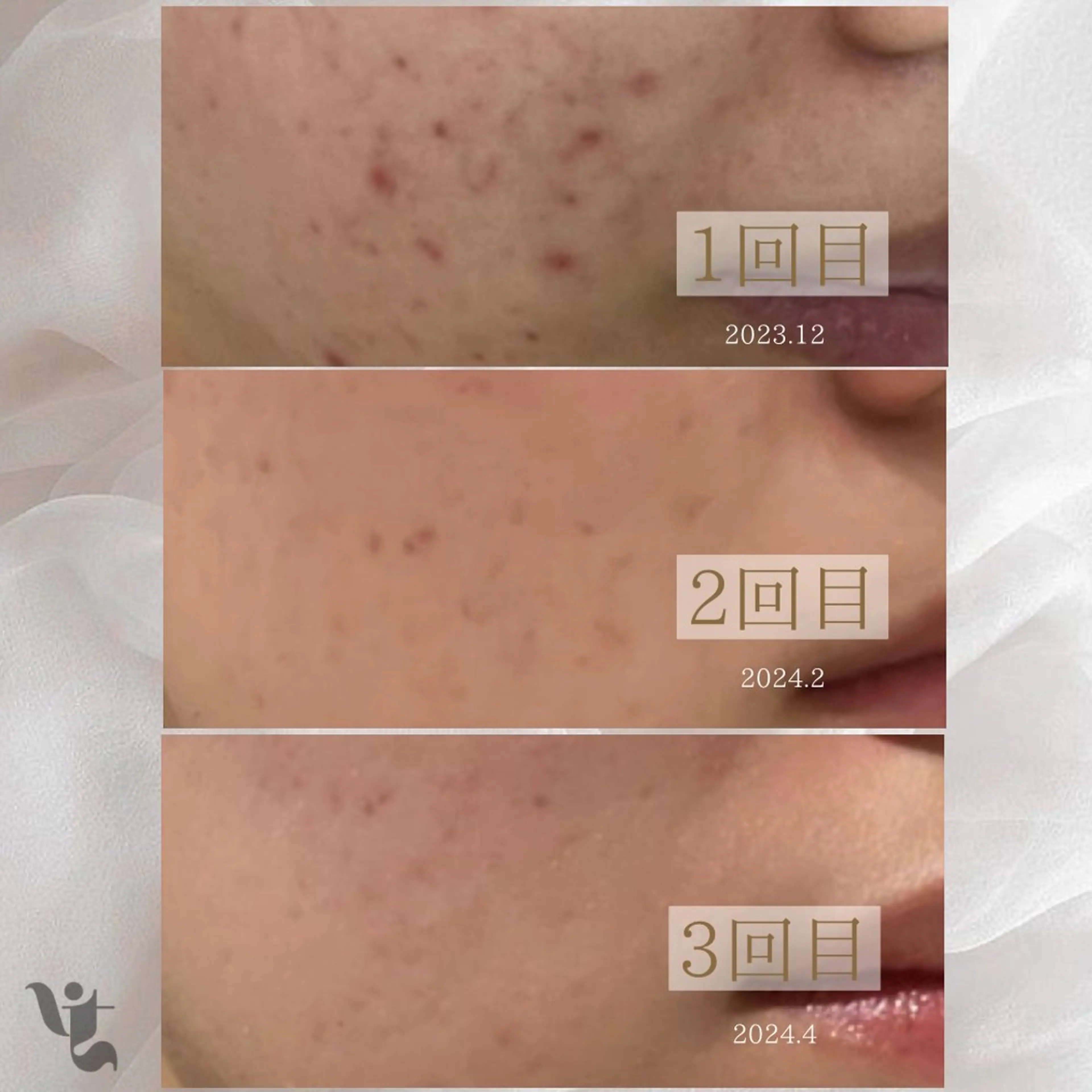 【vidyto】ヴィディトゥ所属・肌管理サロン vidyto　MOEのエステ・リラクイメージ