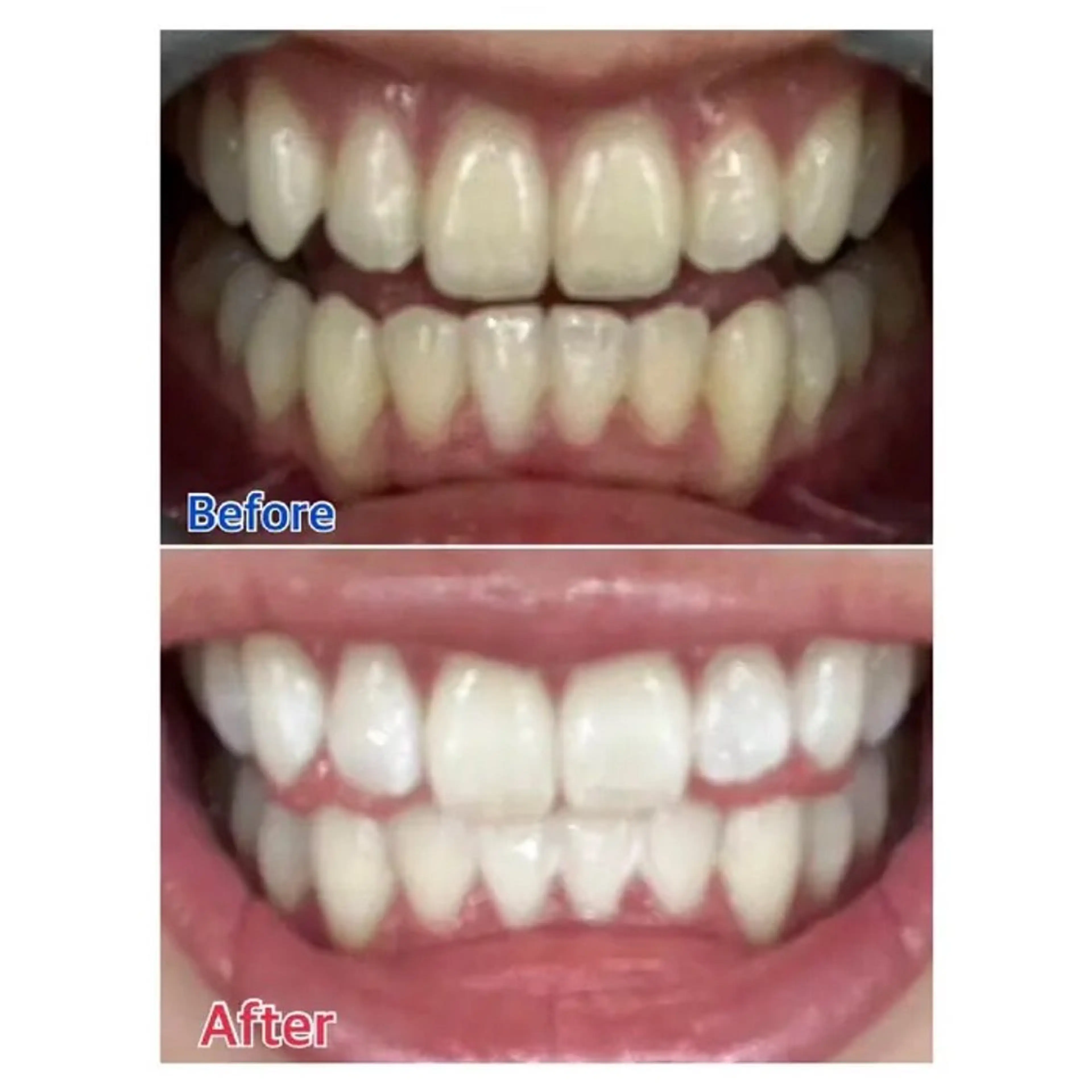 M渋谷店所属・Ｍ渋谷 ホワイトニングのその他イメージ