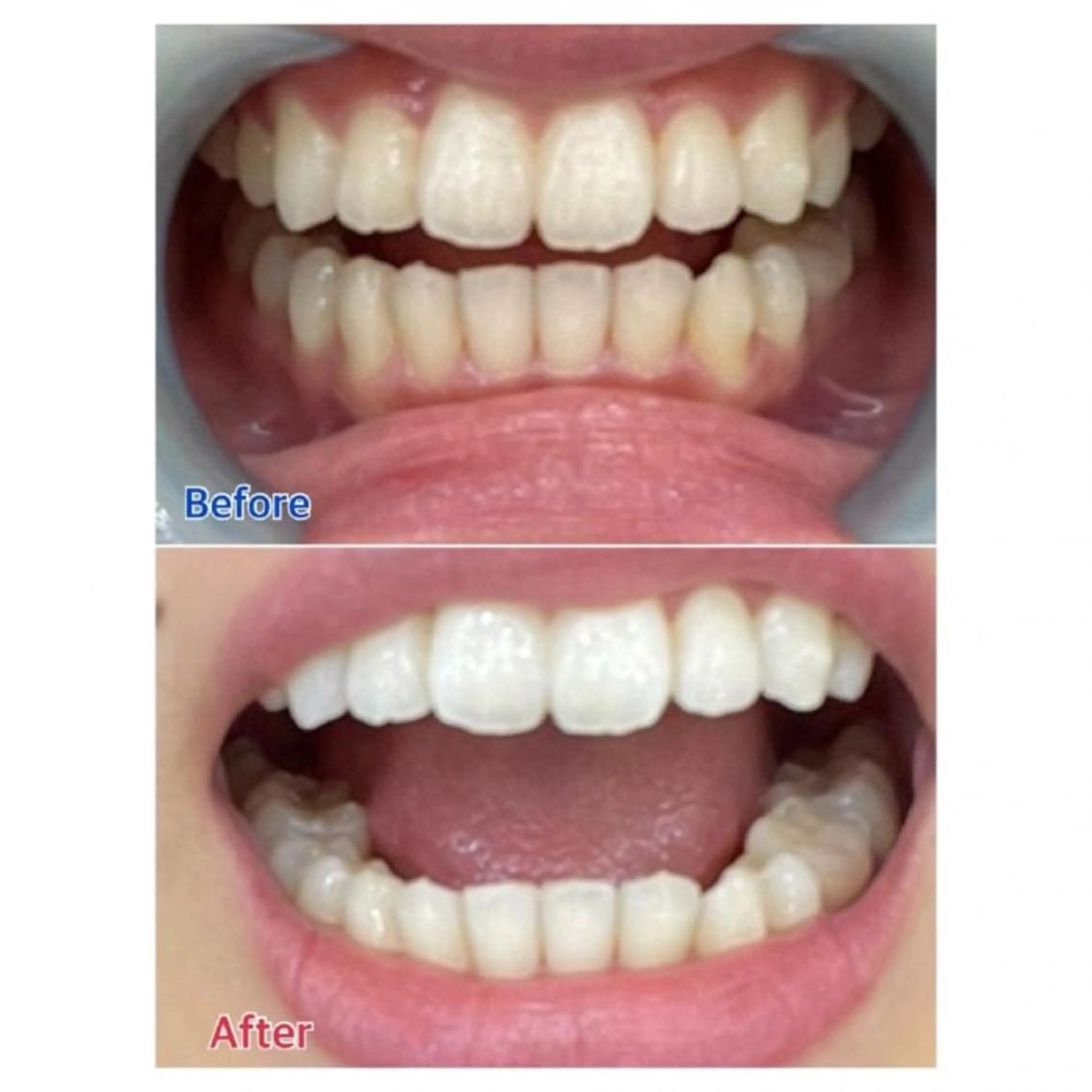 M渋谷店所属・M渋谷 ホワイトニングのエステ・リラクイメージ