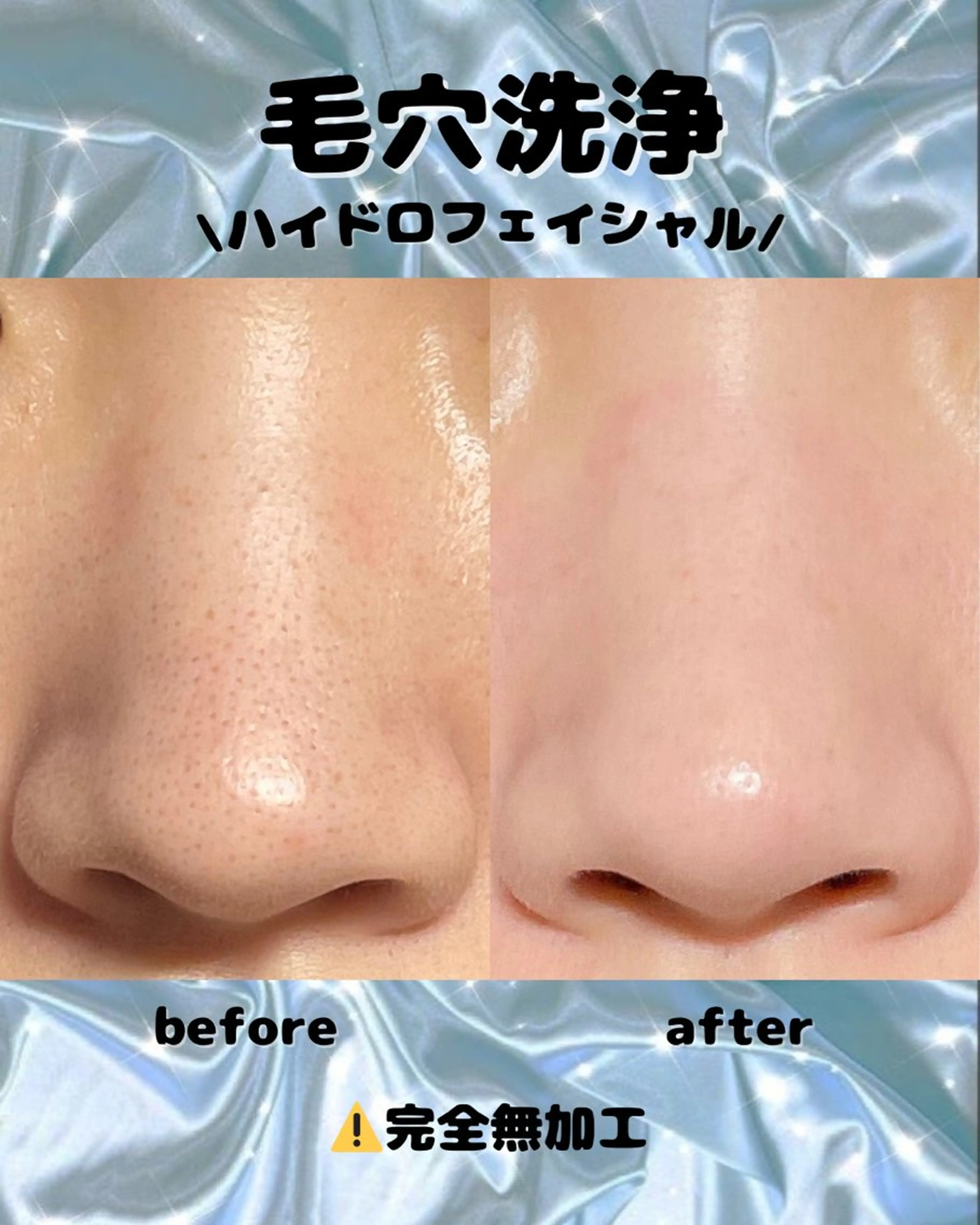 エステ Diailes 💎ななのエステ・リラクイメージ