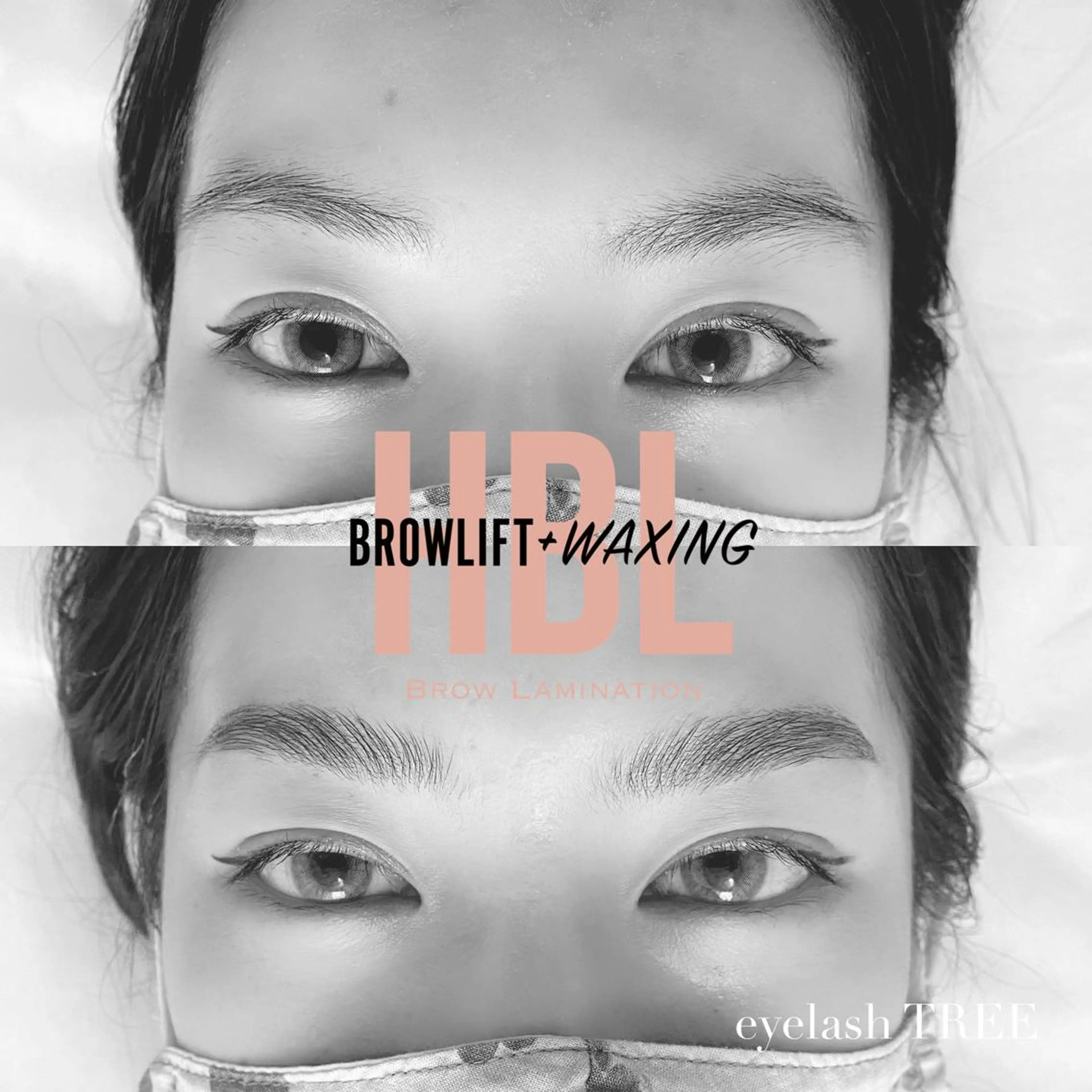 マツエク・マツパ まつげ、毛穴 TREEのエステ・リラクイメージ