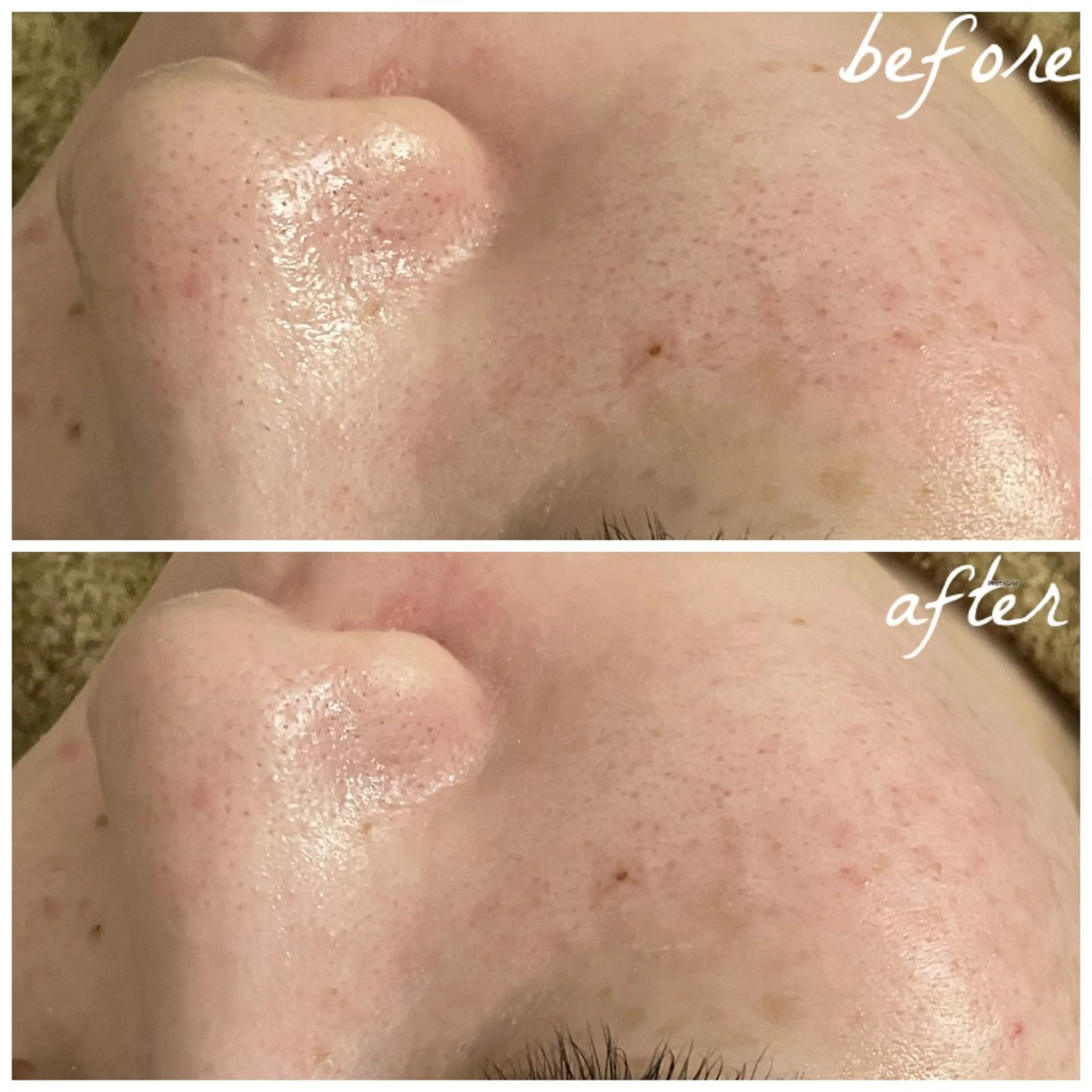 メンズ エステ メナード岐阜茜部 杉浦のエステ・リラクイメージ