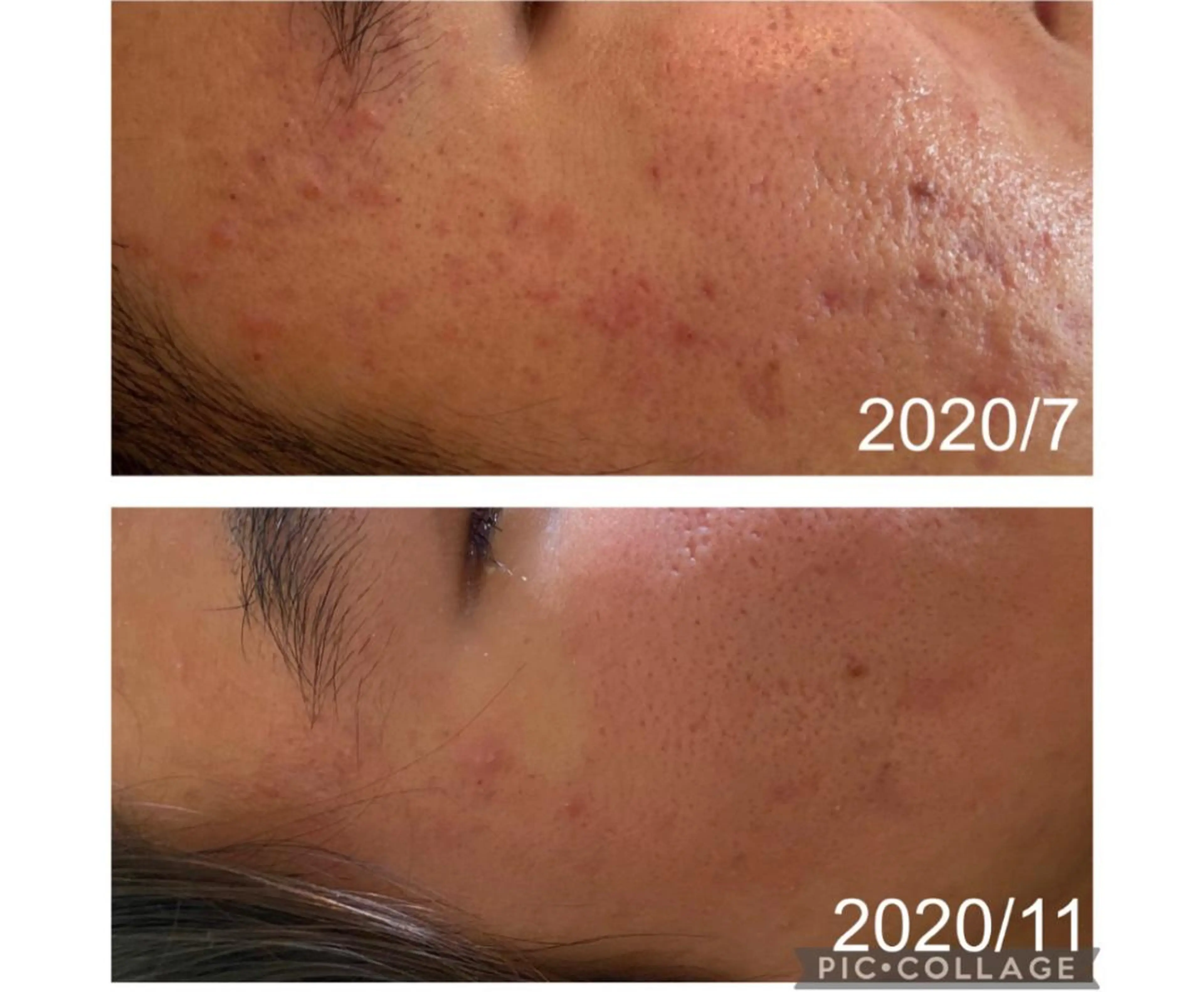 ニキビ改善サロン　縁樹　enju所属・ニキビ専門サロン縁樹 鈴木真樹のエステ・リラクイメージ