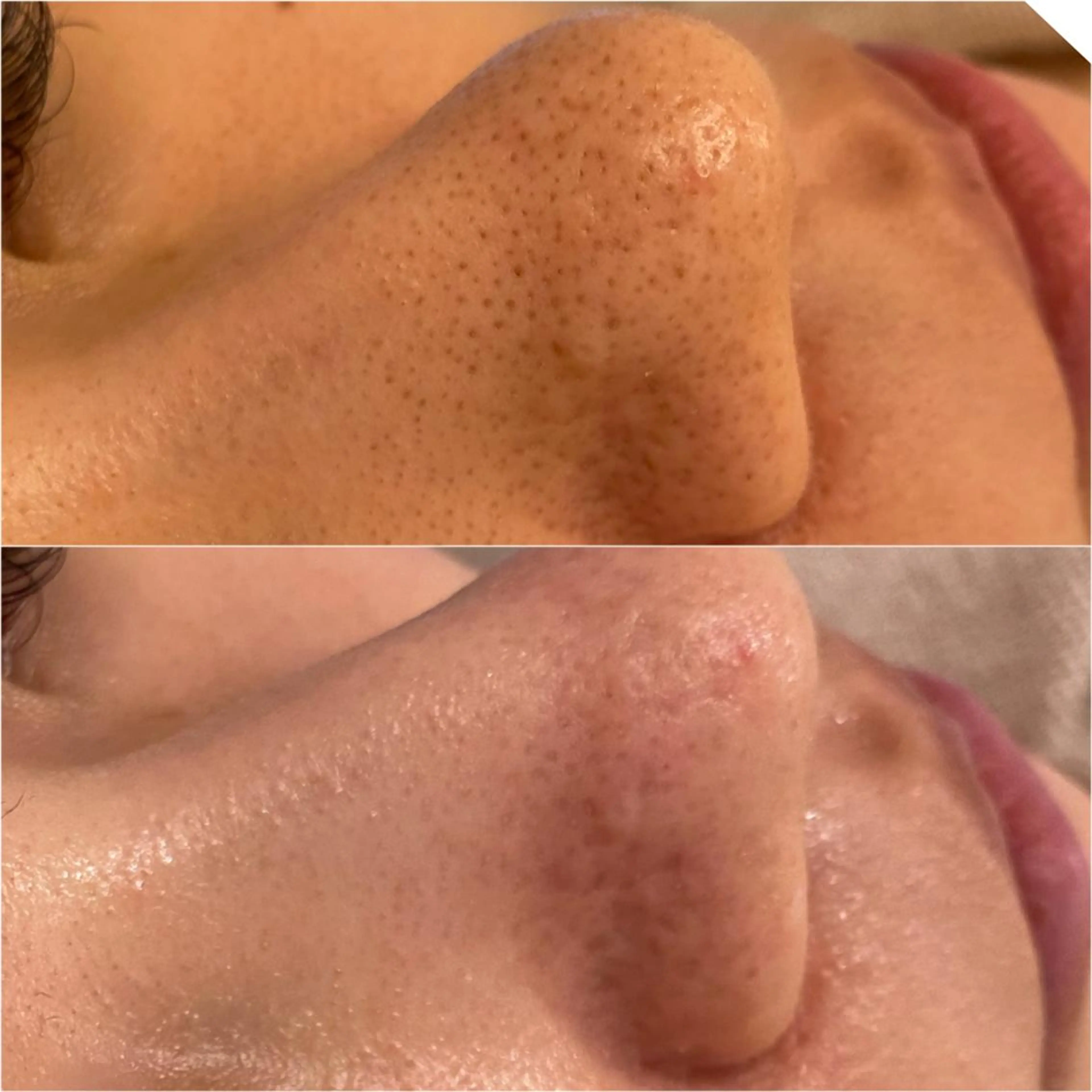 ✨美肌水光✨ アトリエリュバンのエステ・リラクイメージ