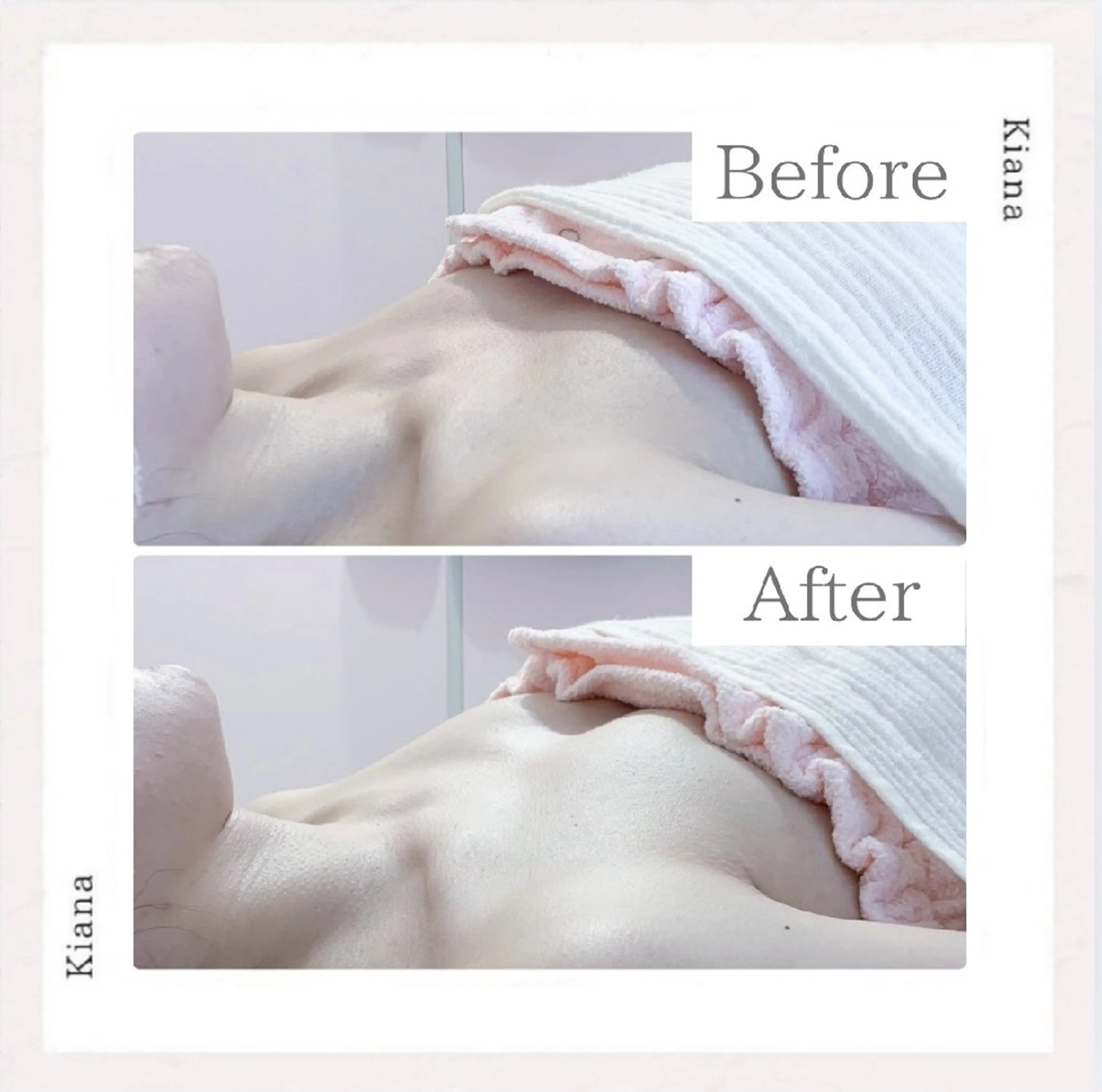 エステ リラク 【バスト専門店 】 Kiana のエステ・リラクイメージ