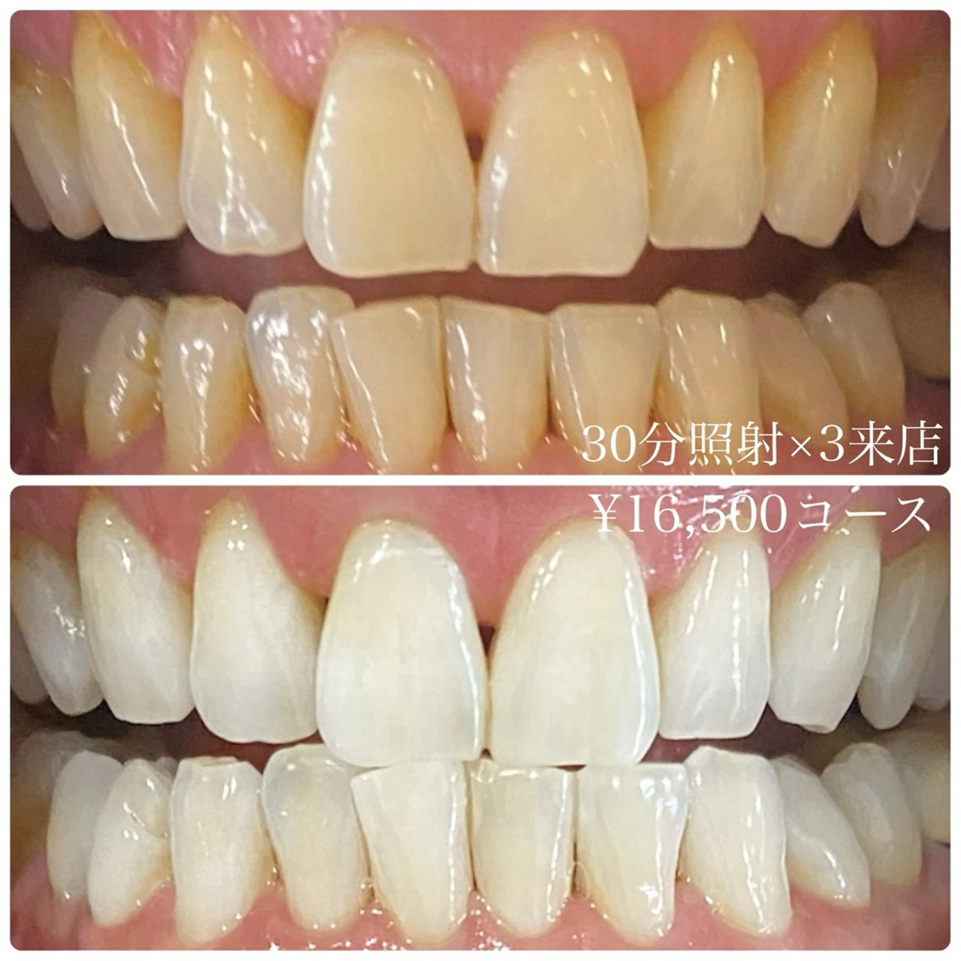 その他 PLATINUM Beauty 横浜店所属・ホワイトニングルーム 横浜店のその他イメージ