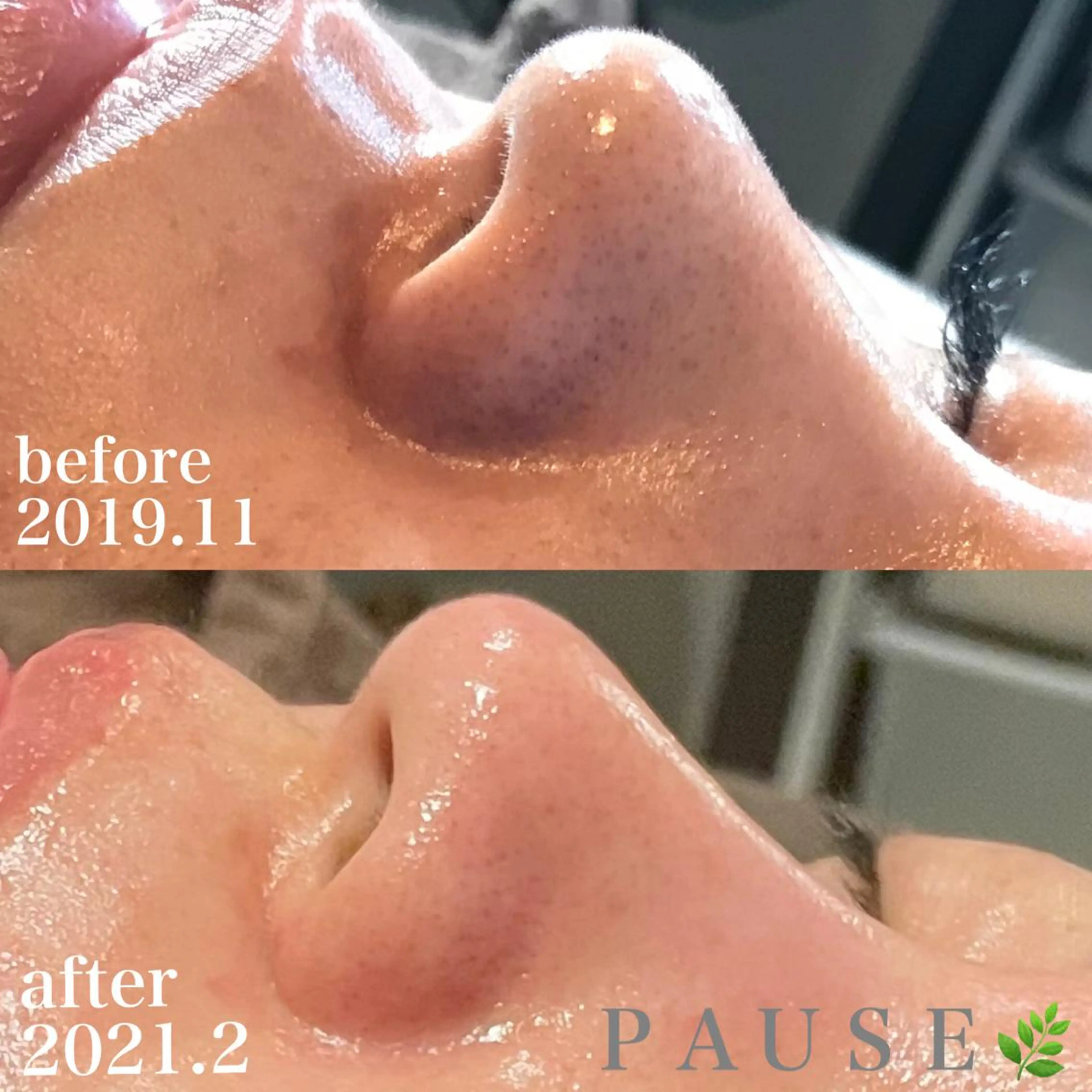 エステ 浜野 恵美のエステ・リラクイメージ