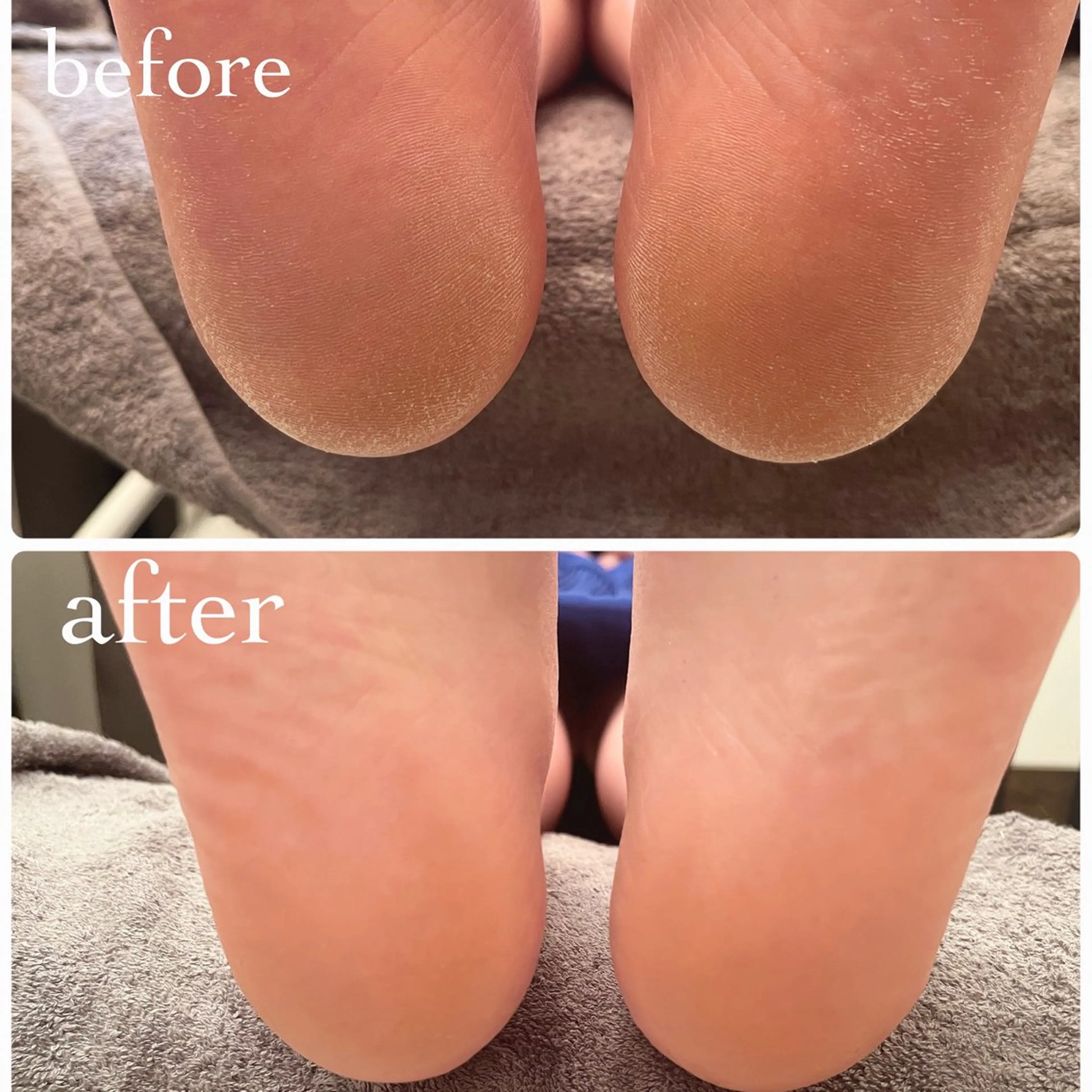 フット角質ケア👣の写真